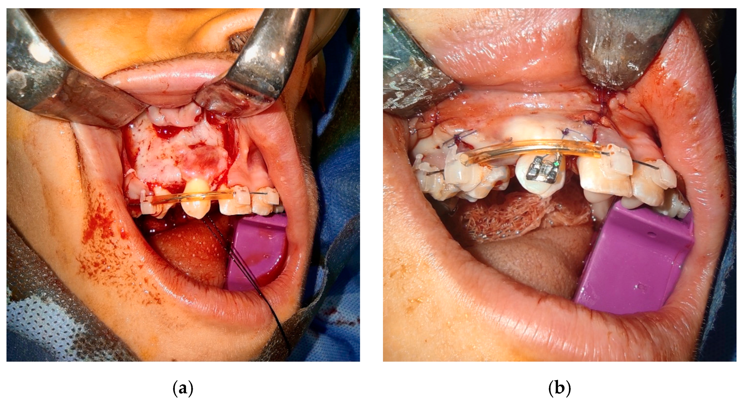 Bioengineering 10 01058 g006