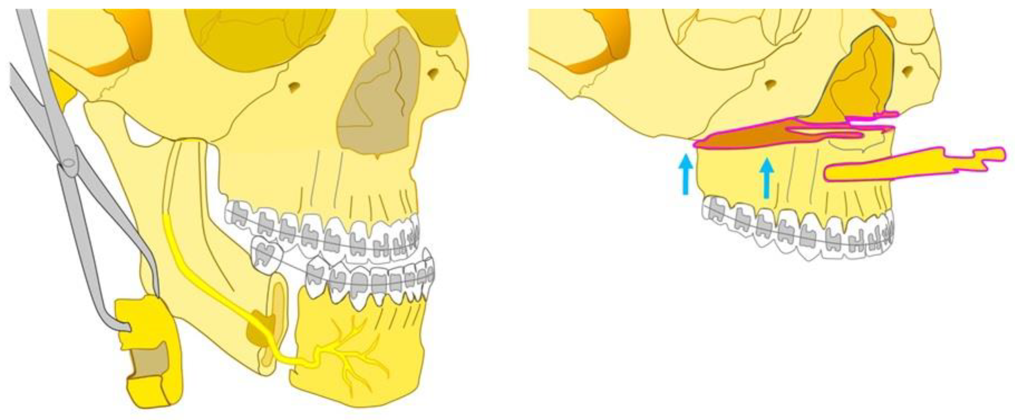 Bioengineering 10 01071 g001