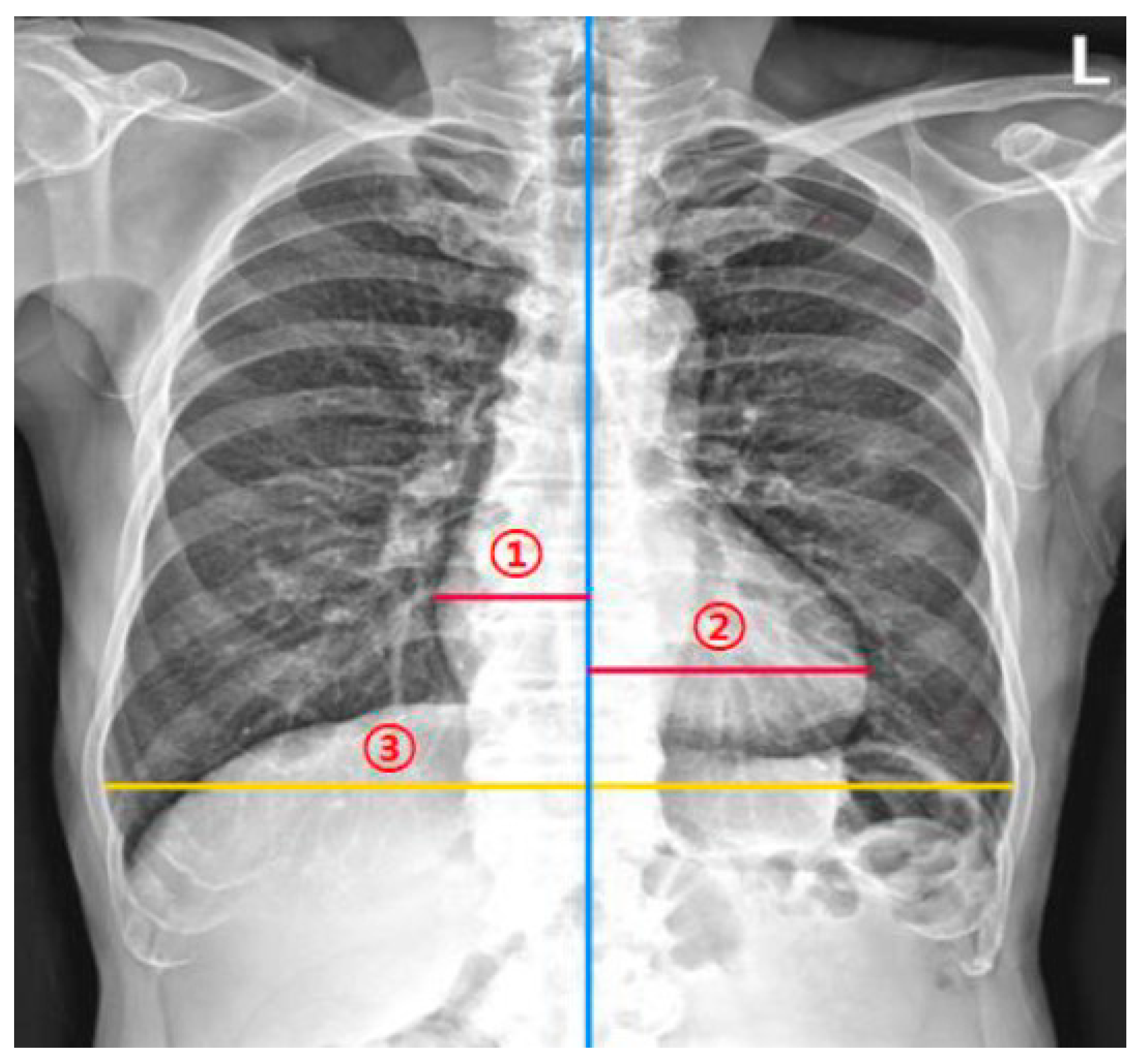 Bioengineering 10 01077 g002