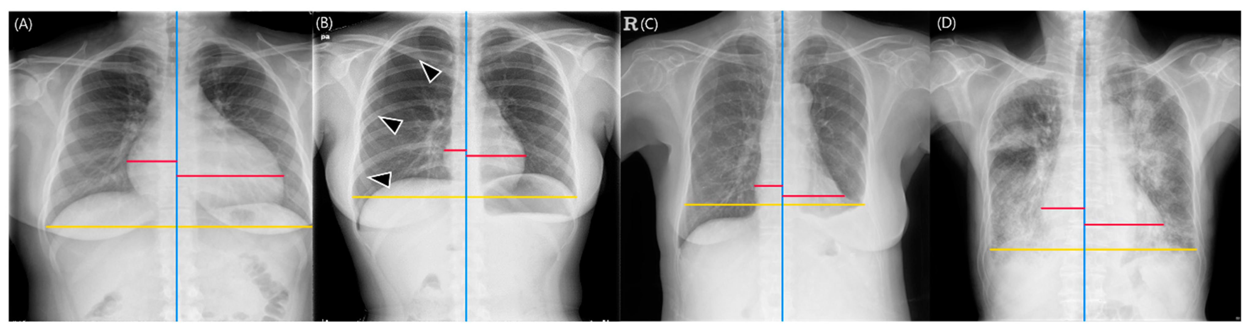 Bioengineering 10 01077 g005