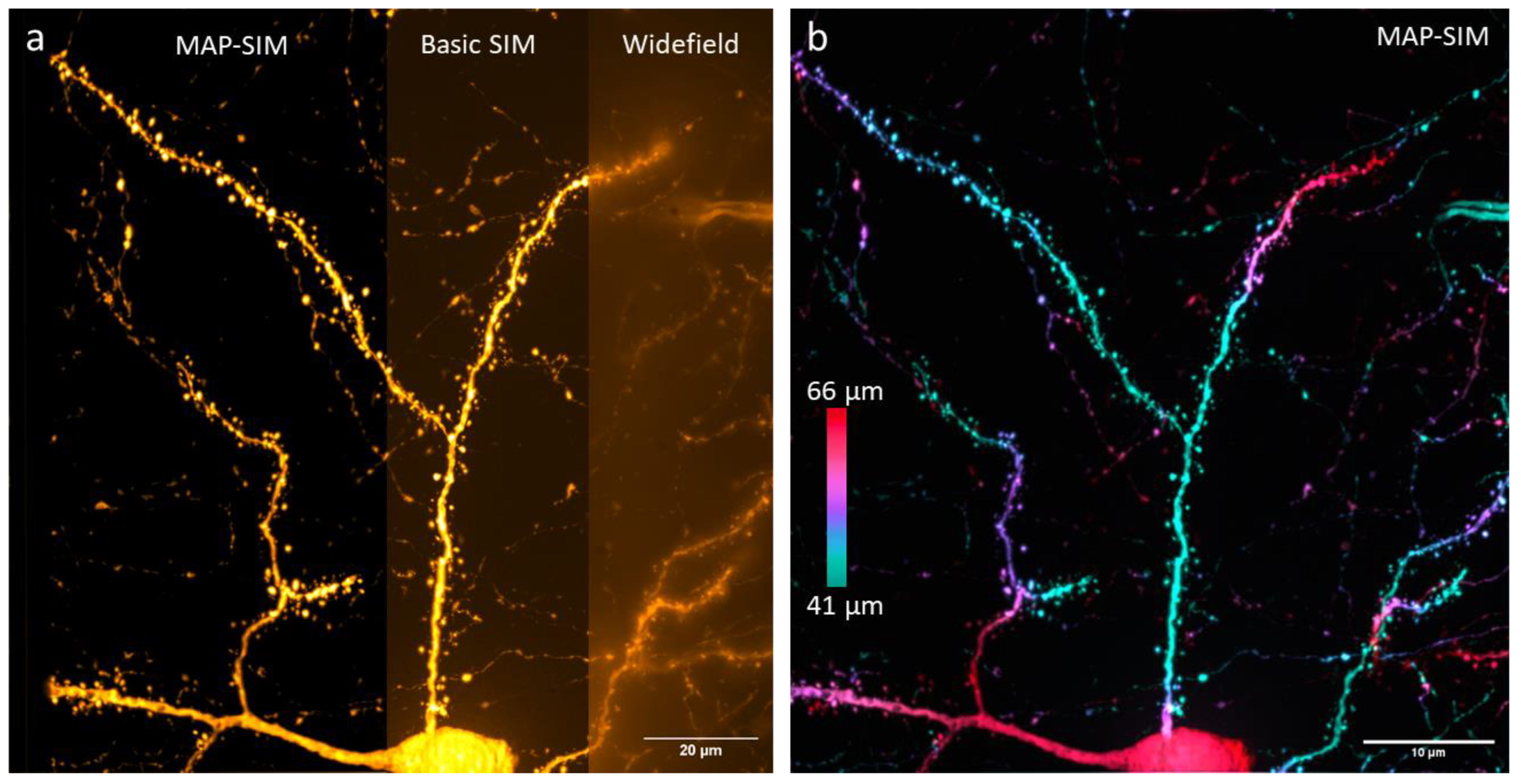 Bioengineering 10 01081 g004