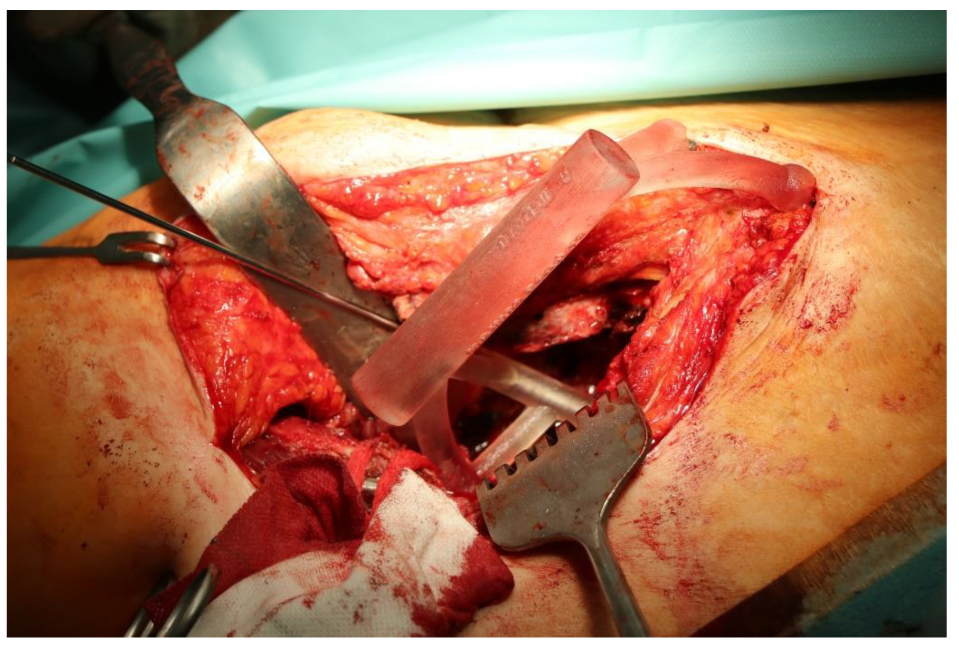 Bioengineering 10 01095 g004