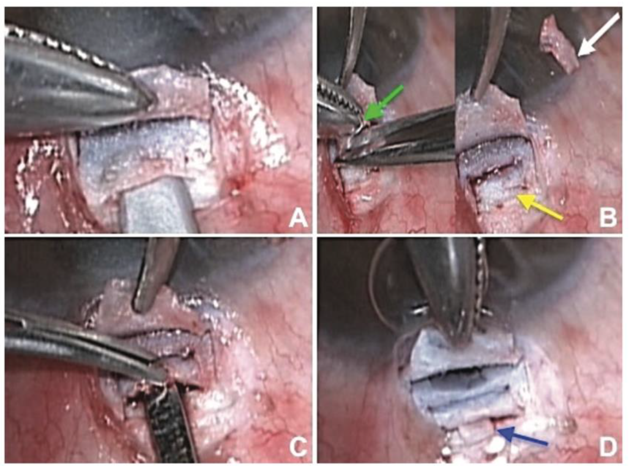 Bioengineering 10 01096 g002