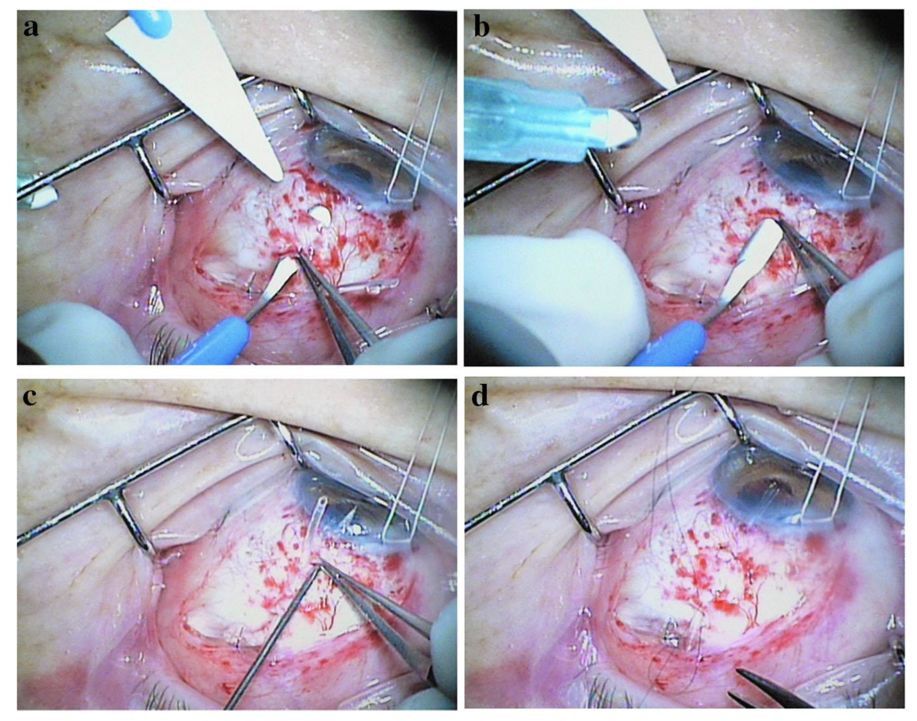 Bioengineering 10 01096 g004