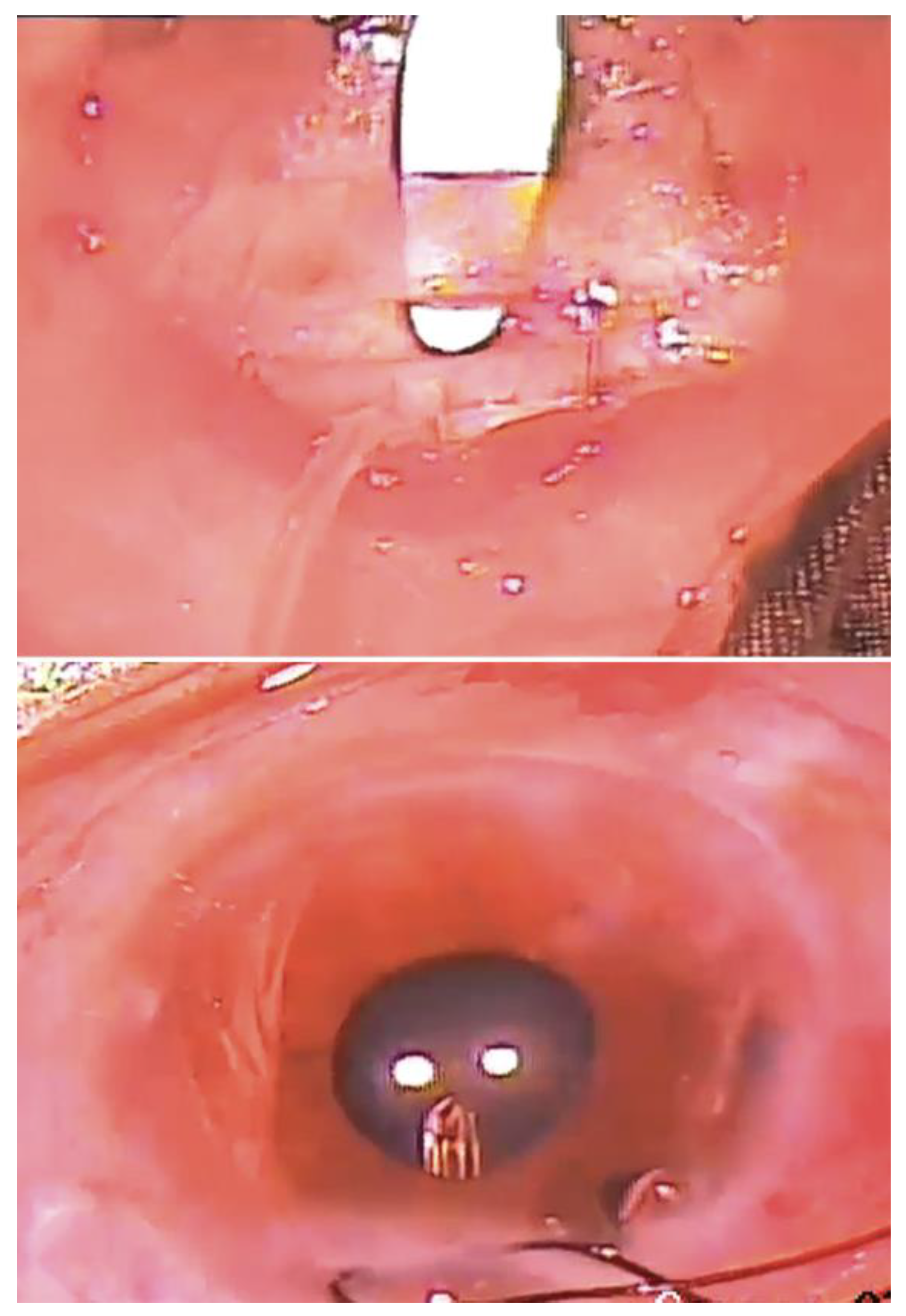 Bioengineering 10 01096 g005