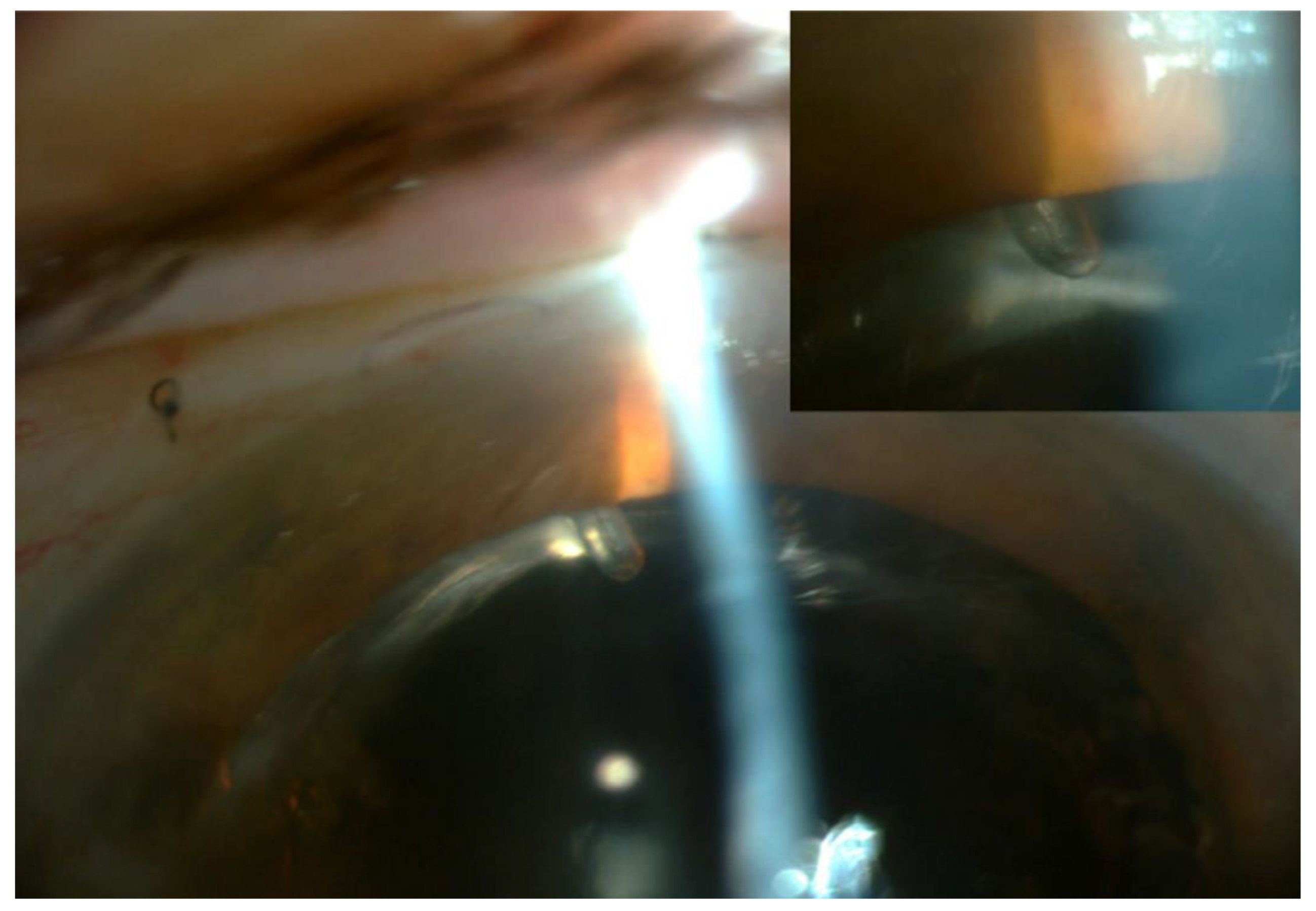 Bioengineering 10 01096 g007