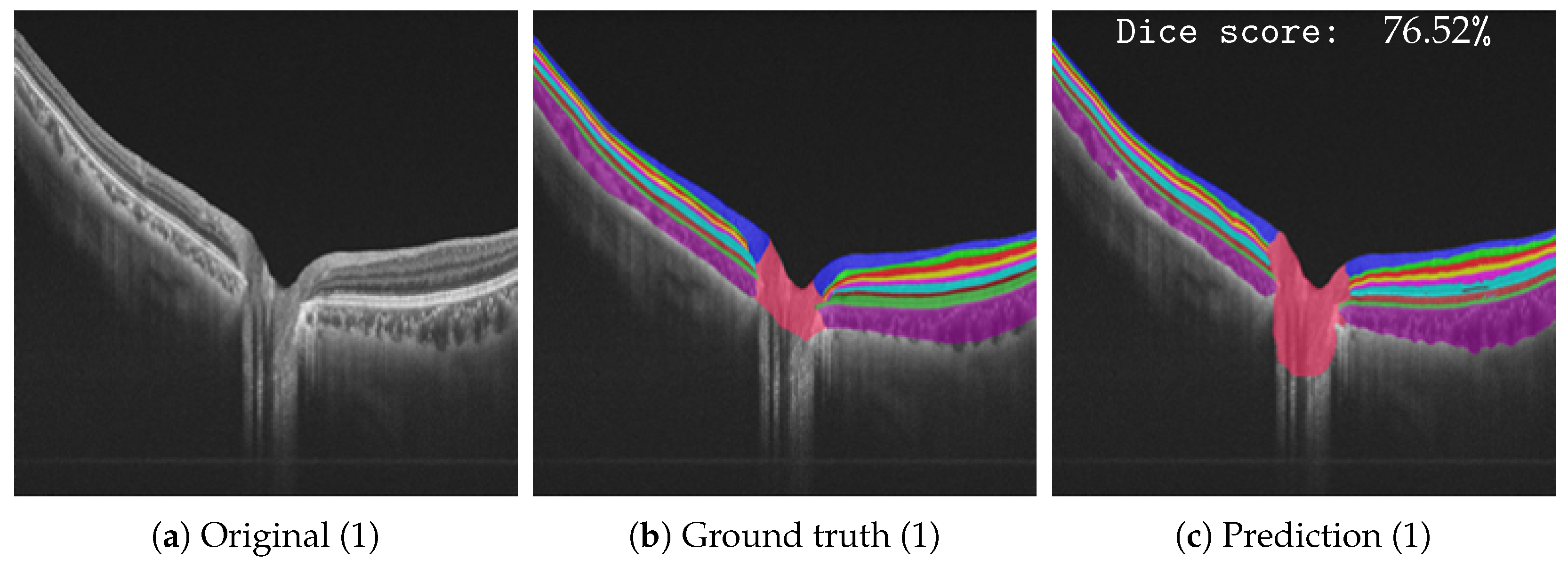 Bioengineering 10 01177 g005a