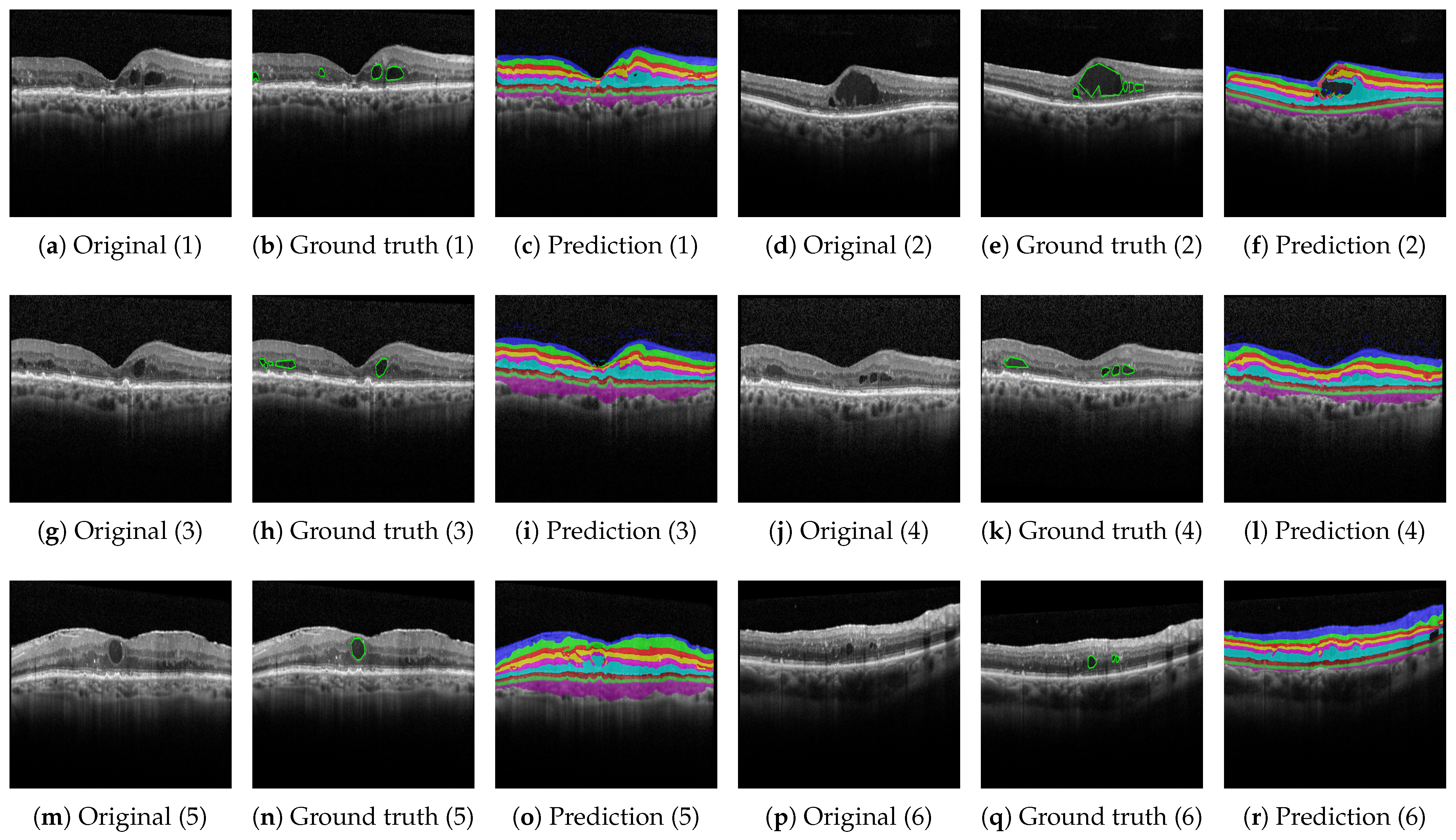 Bioengineering 10 01177 g008