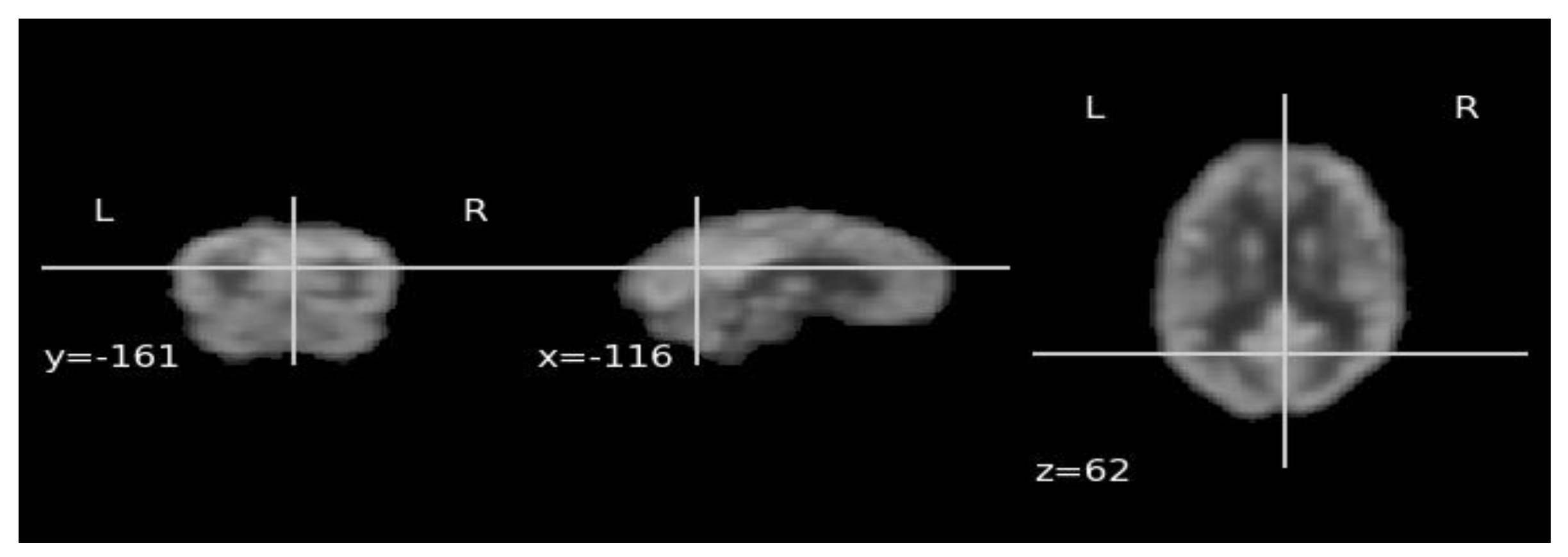 Bioengineering 10 01225 g003