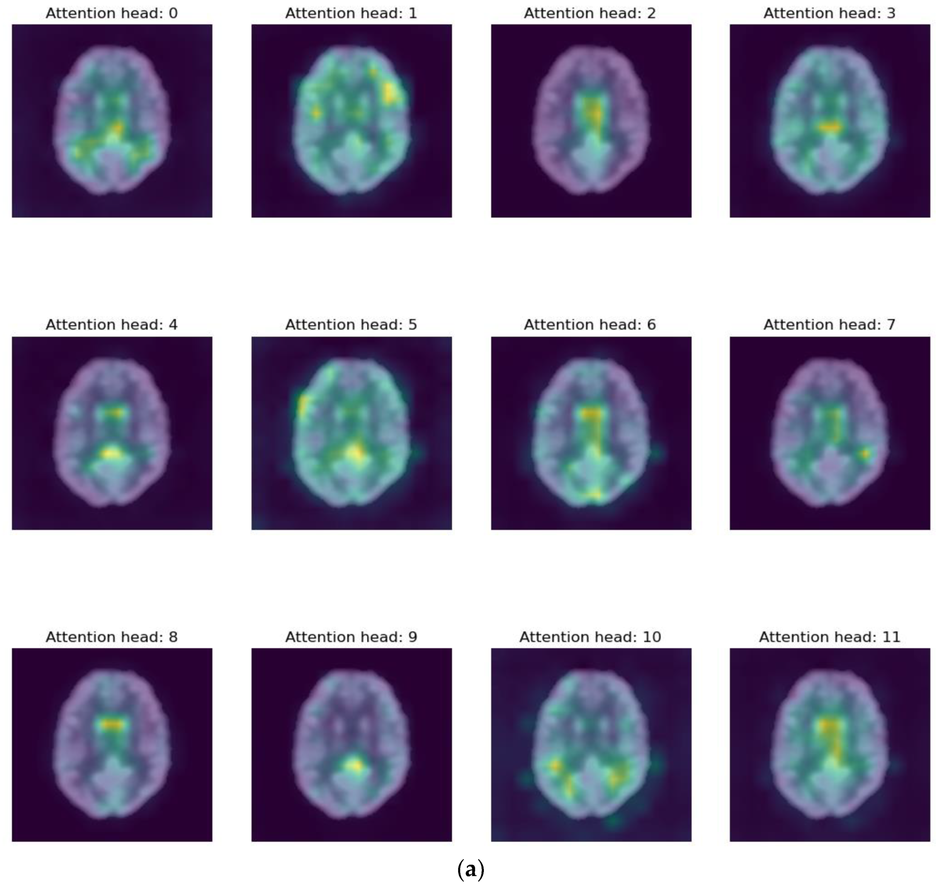Bioengineering 10 01225 g007a