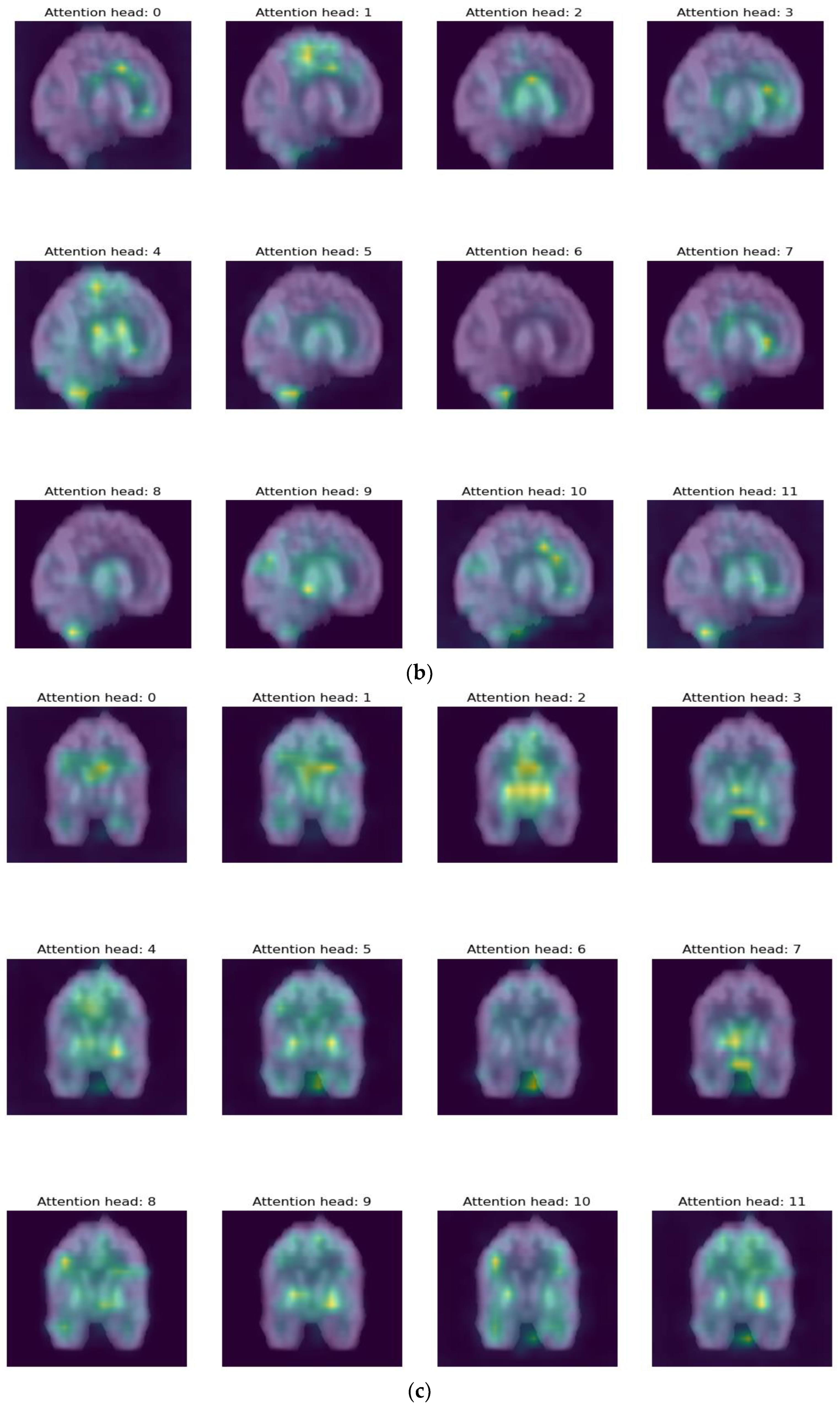 Bioengineering 10 01225 g007b