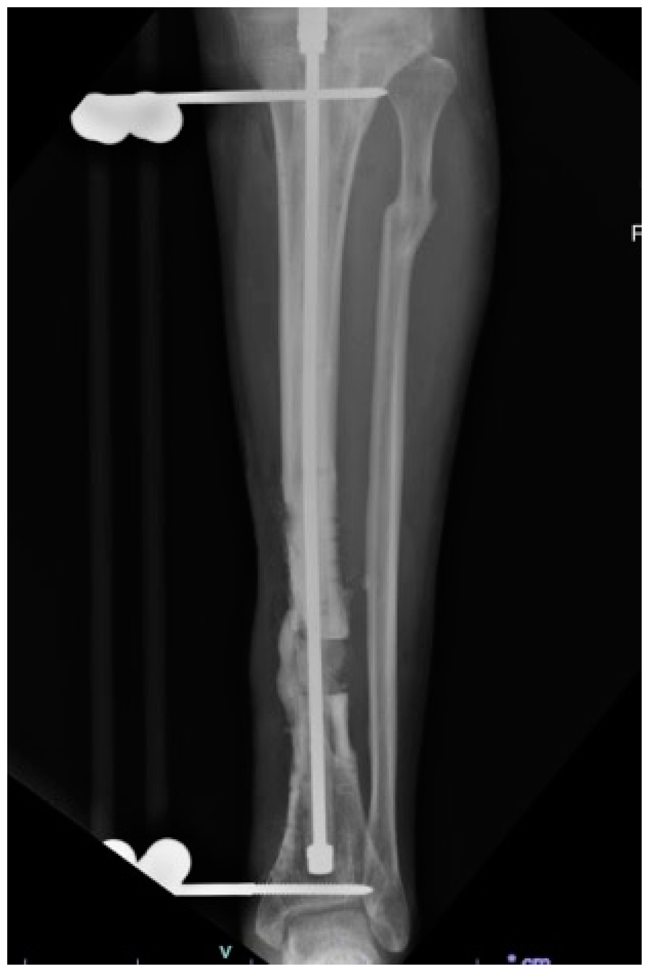 Bioengineering 10 01252 g001