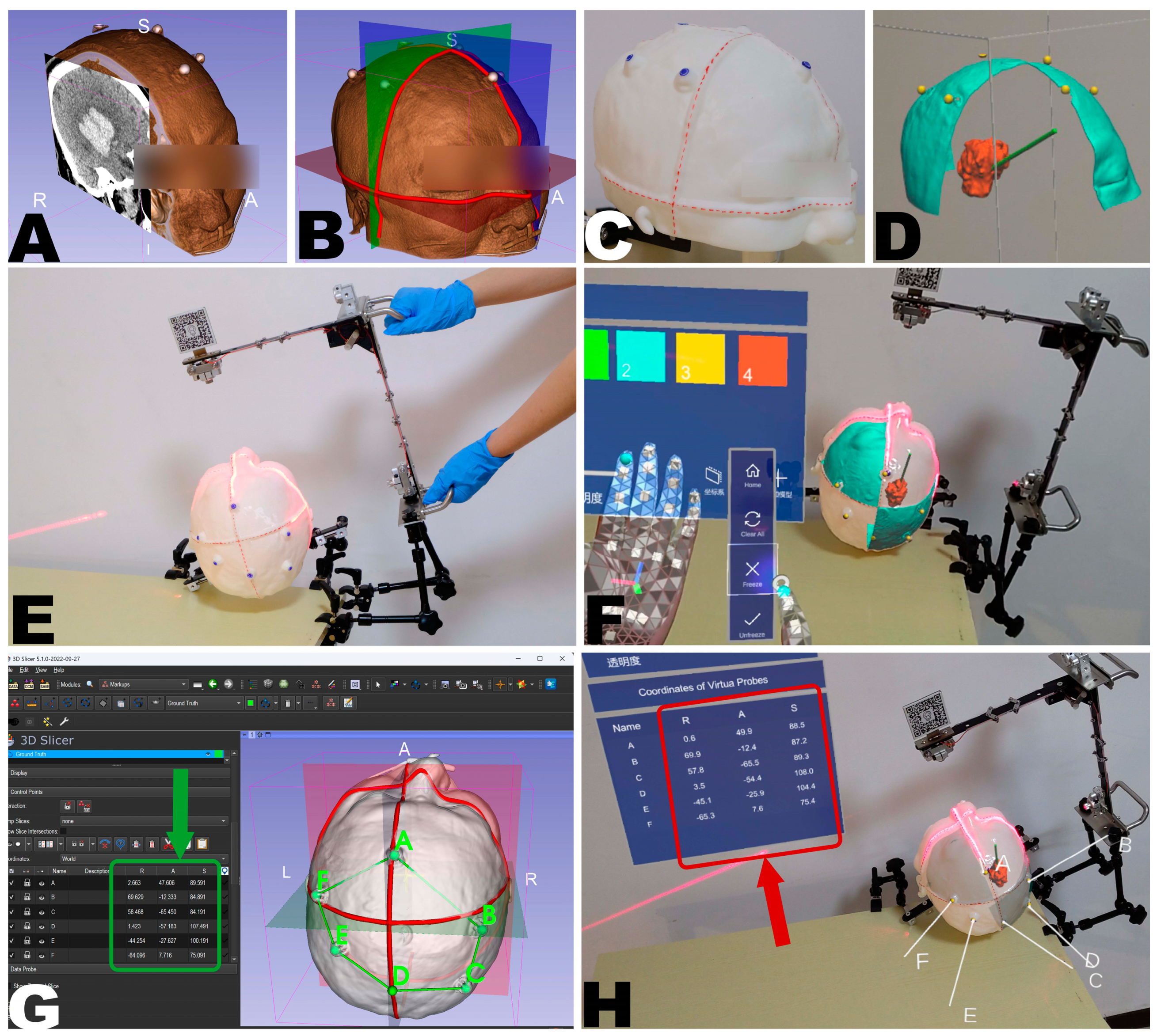 Bioengineering 10 01290 g007