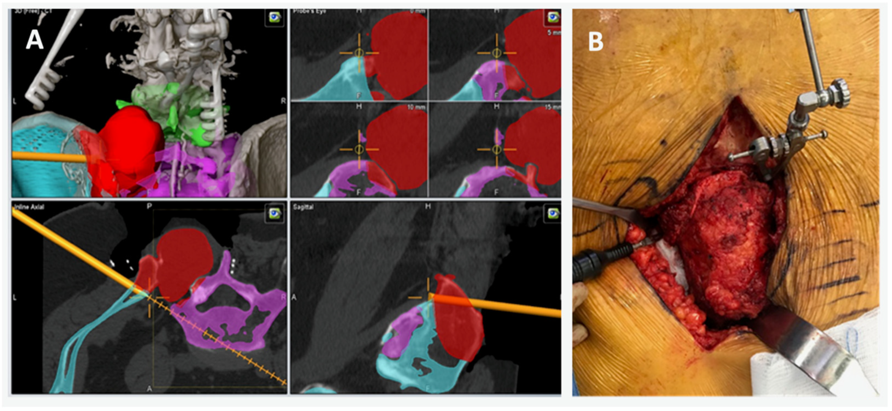 Bioengineering 10 01342 g004