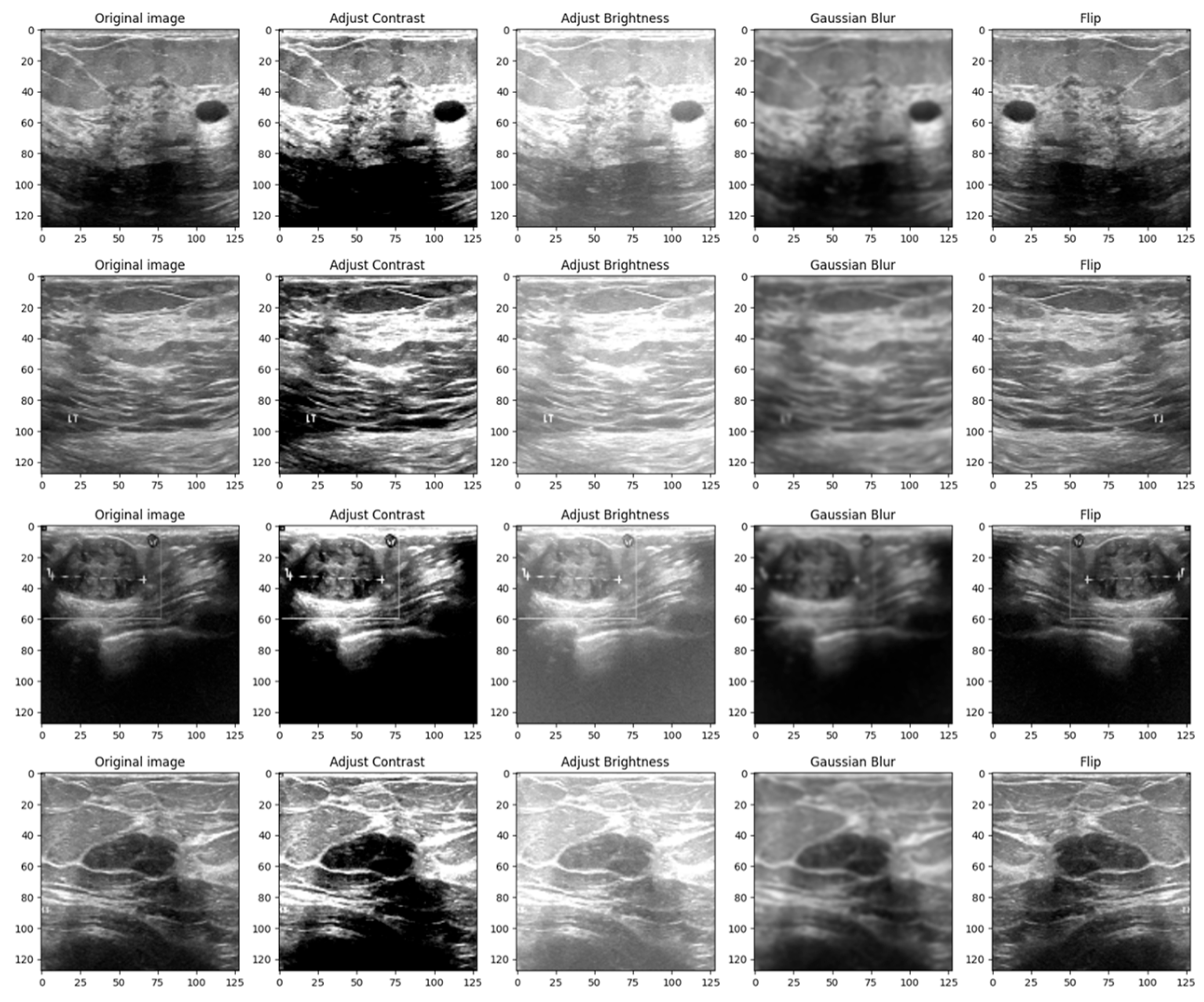 Bioengineering 10 01419 g004