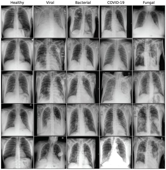 Bioengineering 10 01421 g0a1