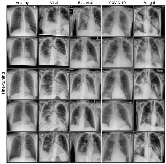Bioengineering 10 01421 g0a5