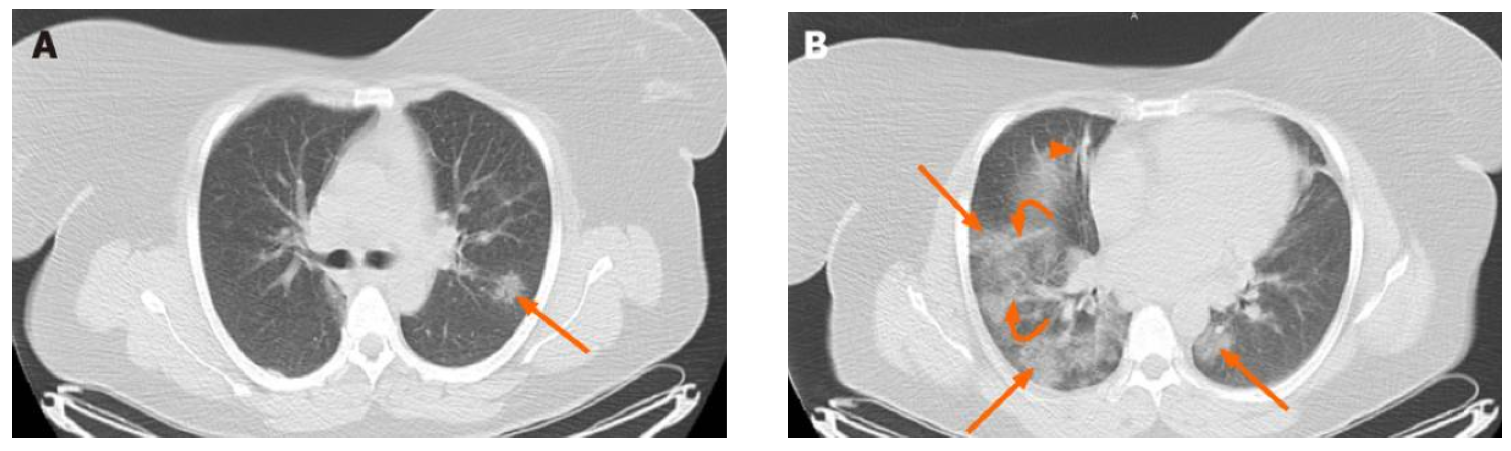 Bioengineering 11 00079 g001