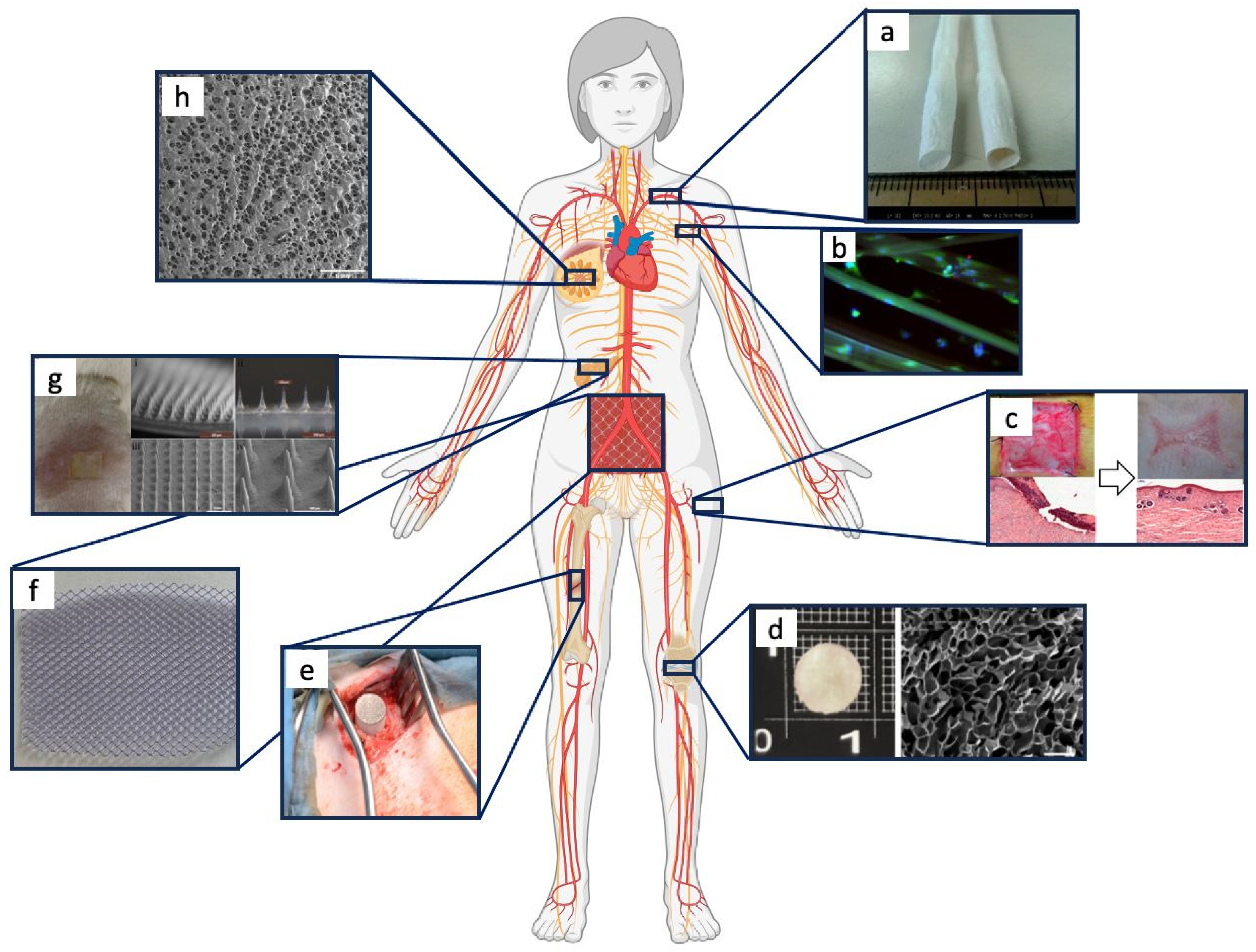 Bioengineering 11 00167 g004 Bioengineering 11 00167 g004
