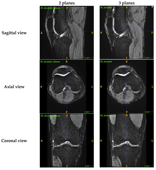 Bioengineering 11 00186 g0a1