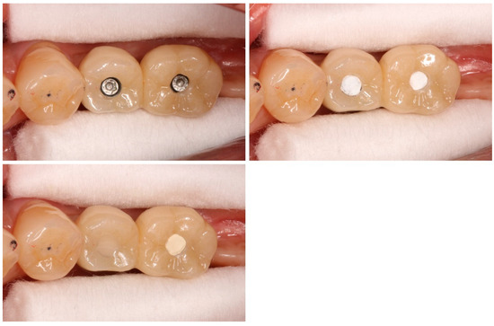 Bioengineering 11 00195 g001