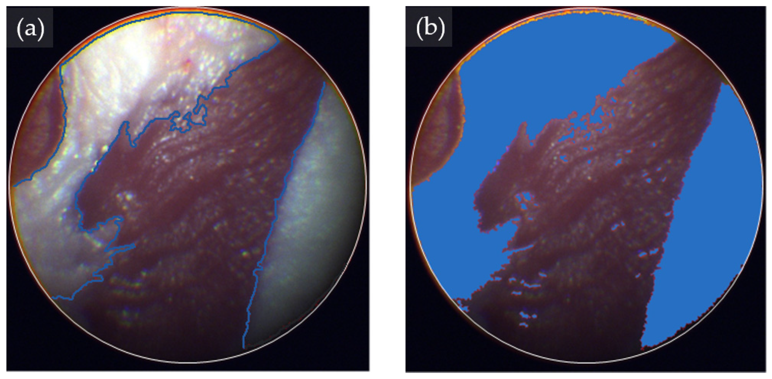 Bioengineering 11 00208 g005
