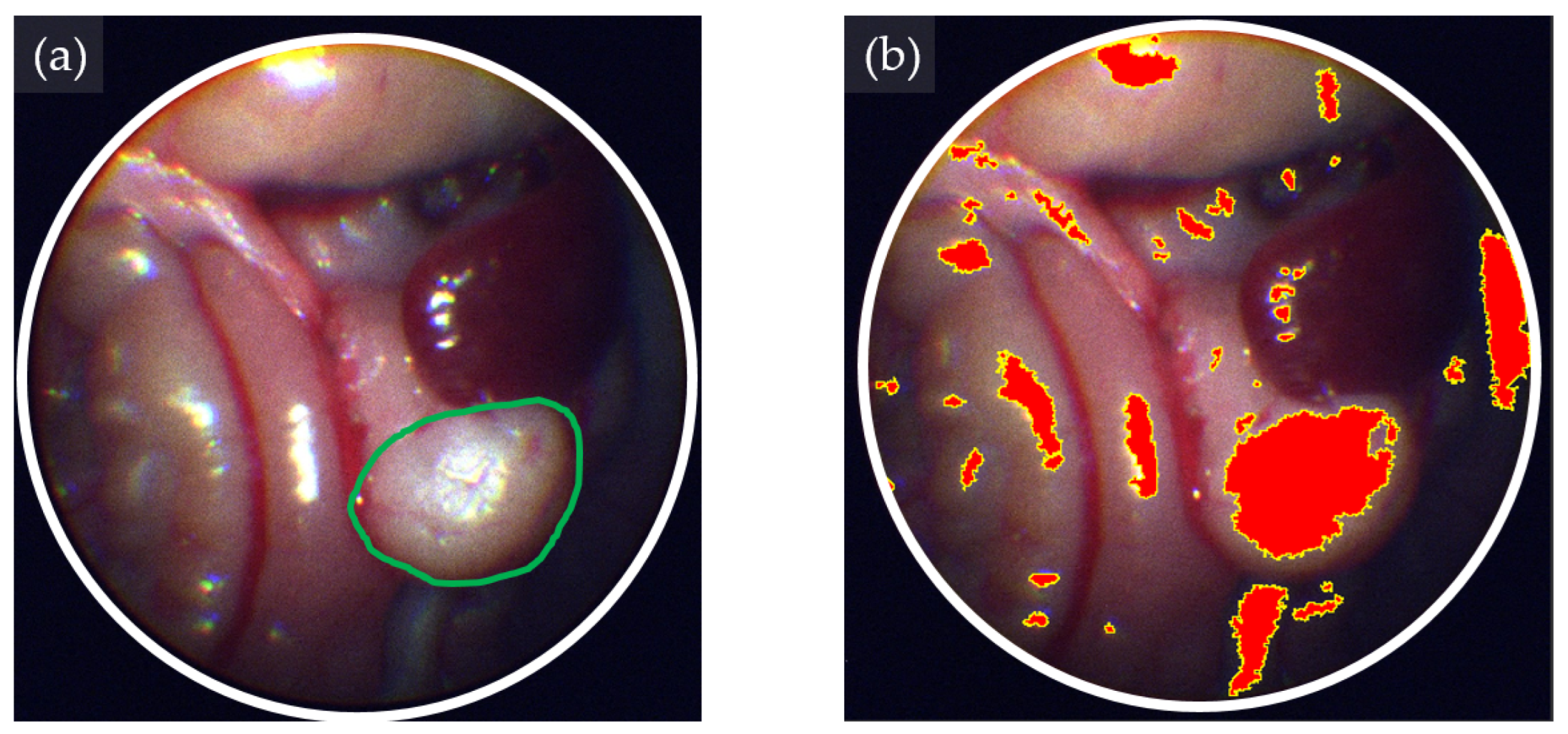 Bioengineering 11 00208 g007