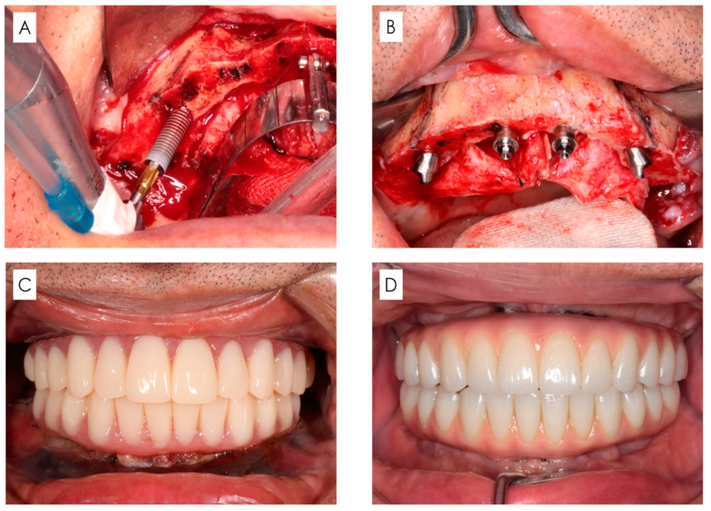 Bioengineering 11 00223 g002 Bioengineering 11 00223 g002