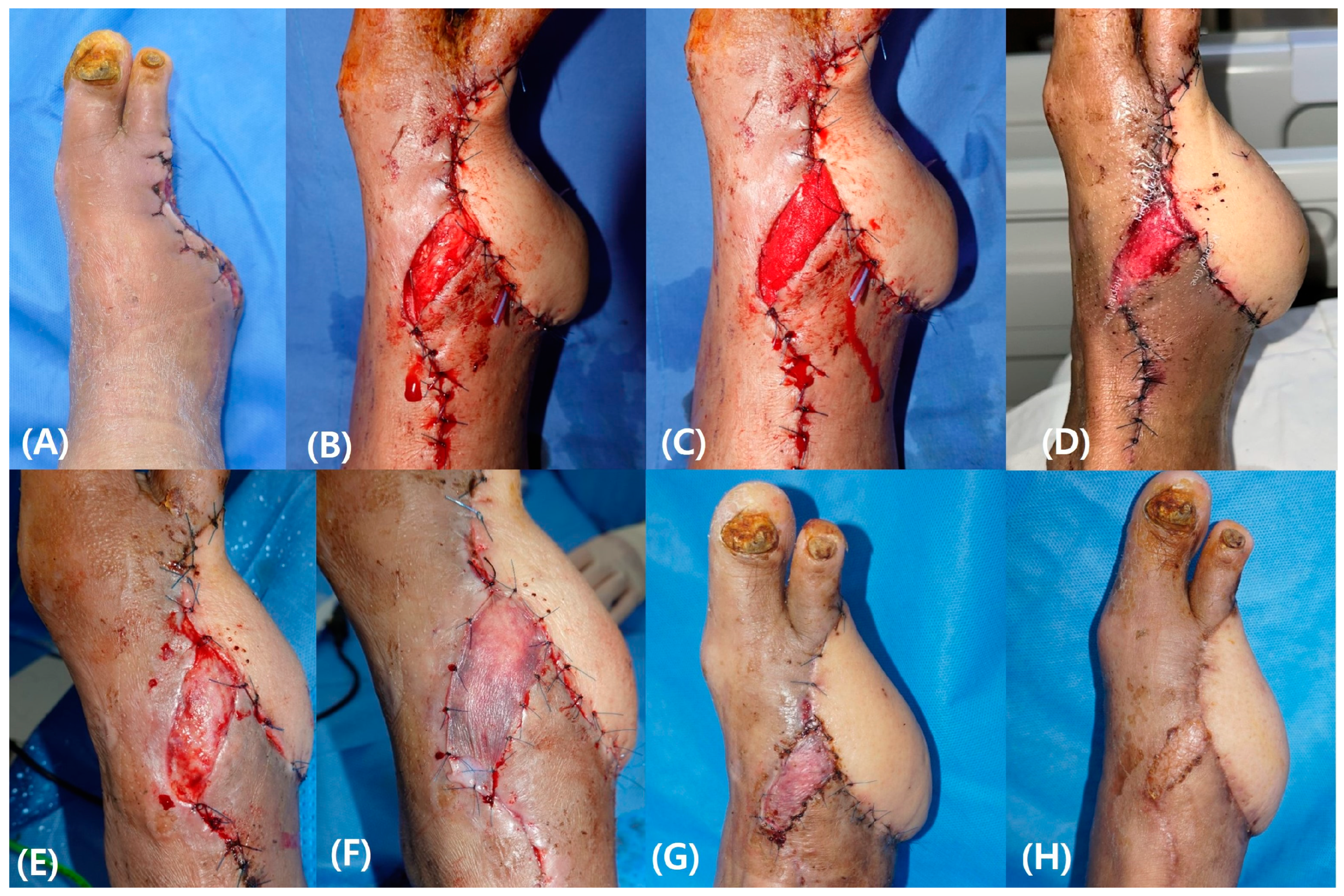 Bioengineering 11 00241 g004