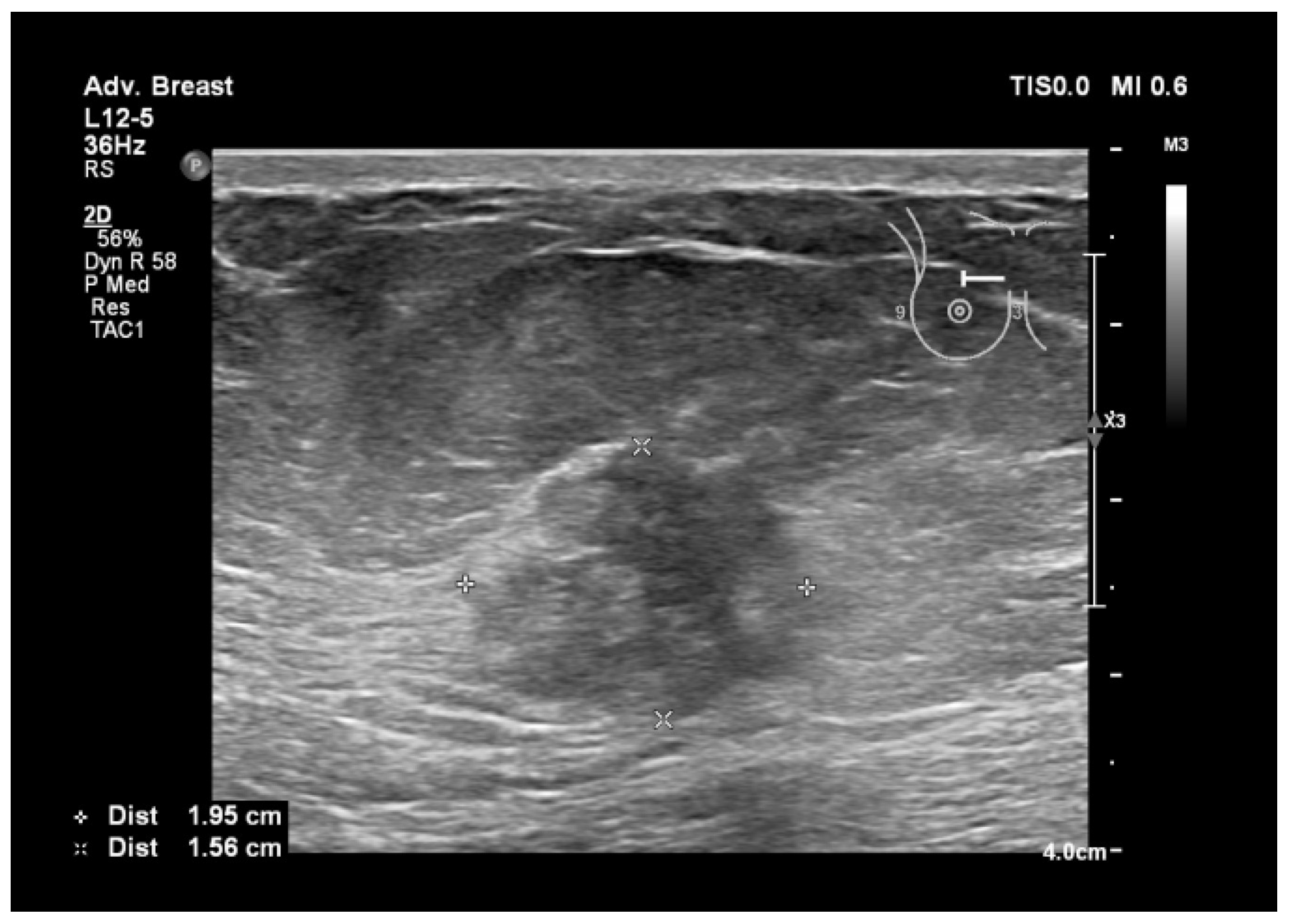 Bioengineering 11 00262 g006