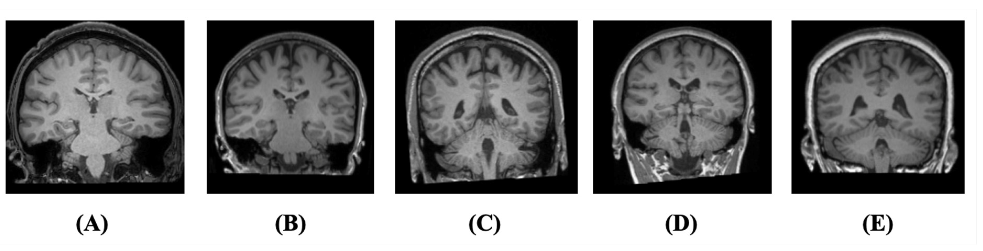 Bioengineering 11 00265 g004