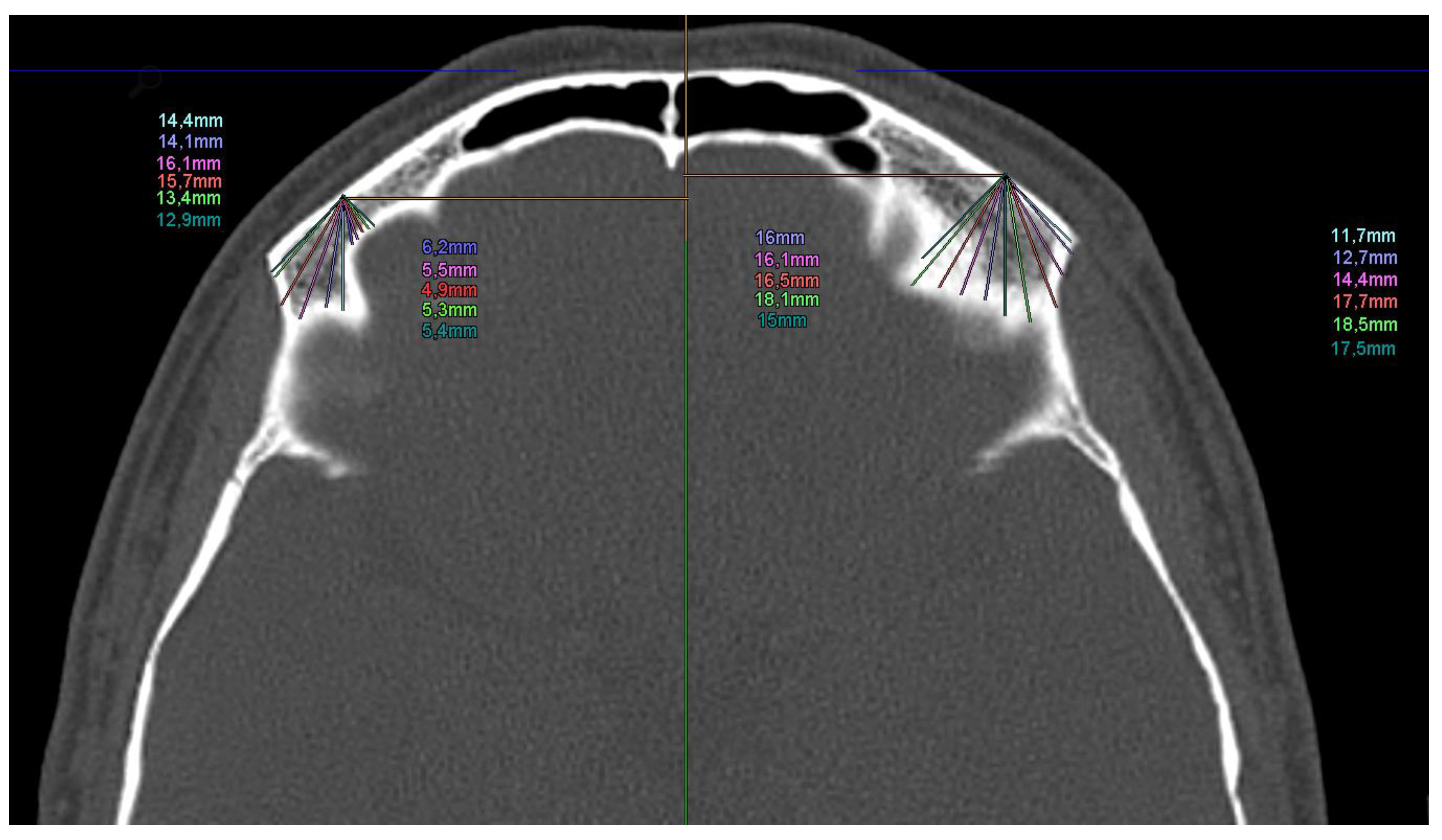 Bioengineering 11 00279 g002