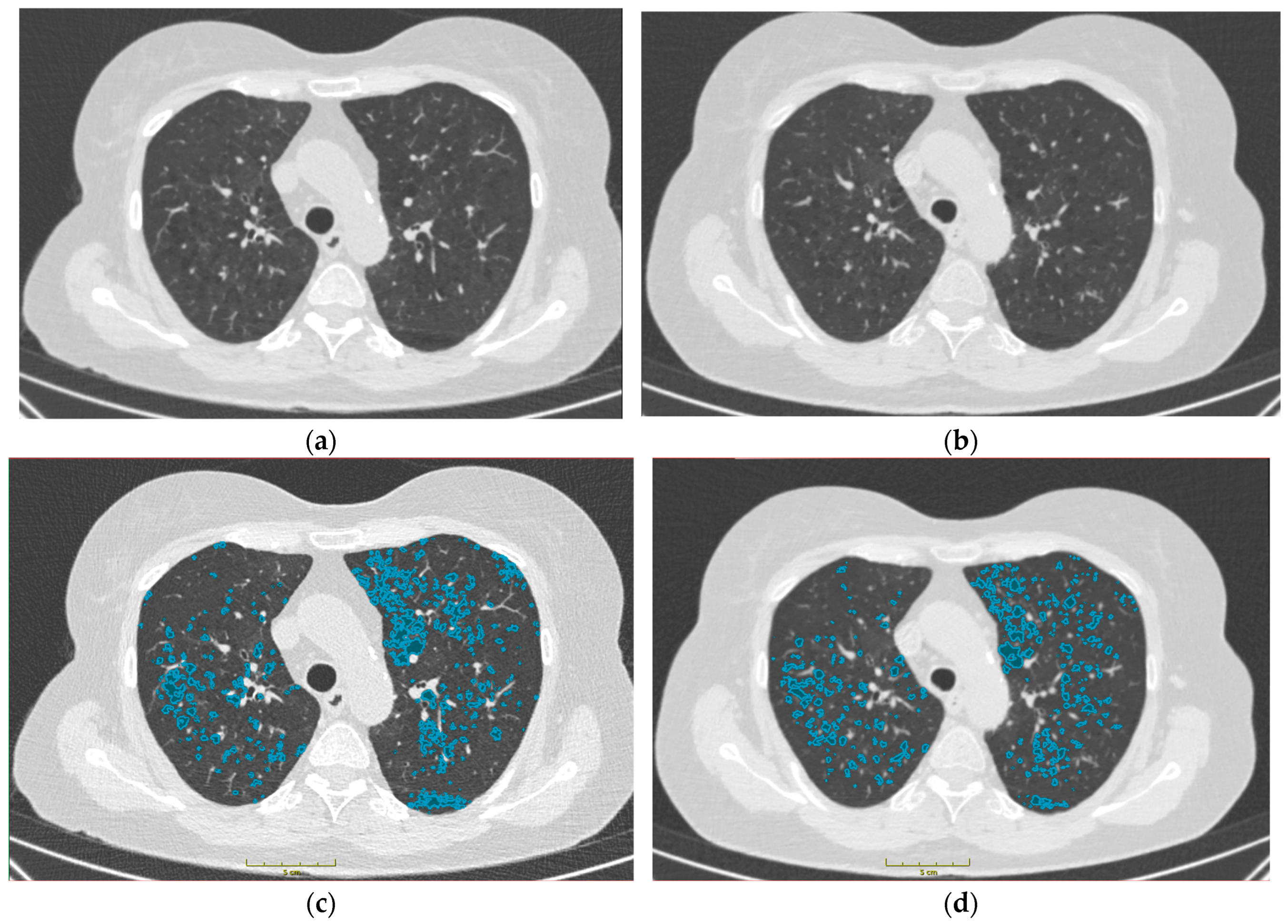 Bioengineering 11 00301 g001