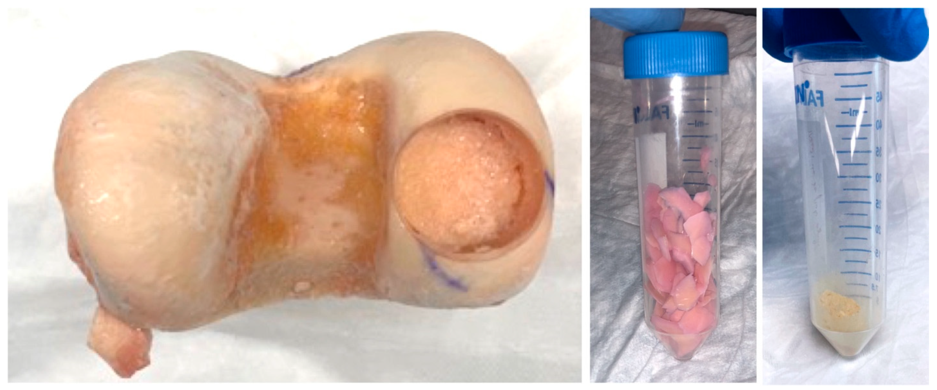 Bioengineering 11 00329 g001