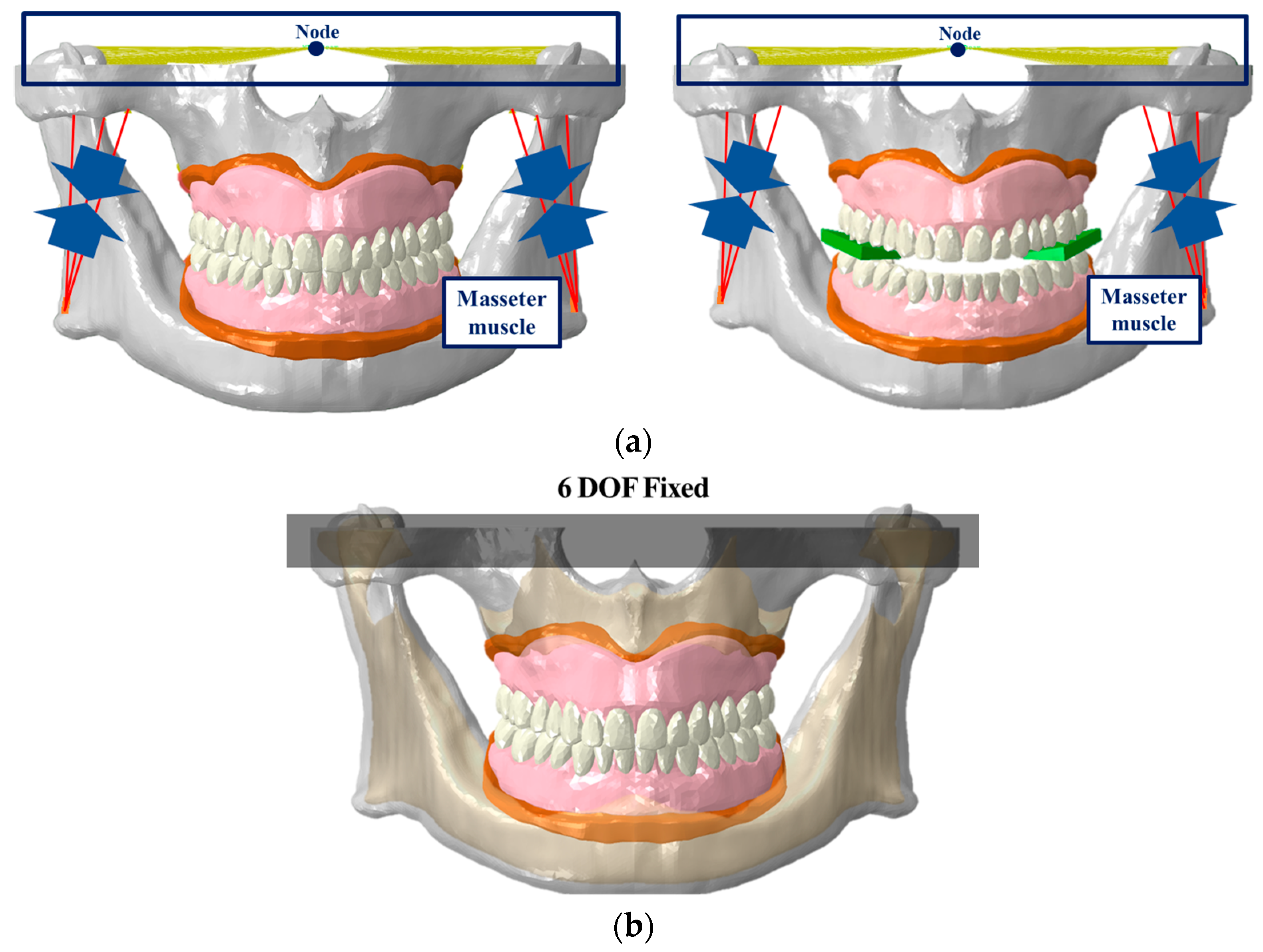 Bioengineering 11 00336 g004