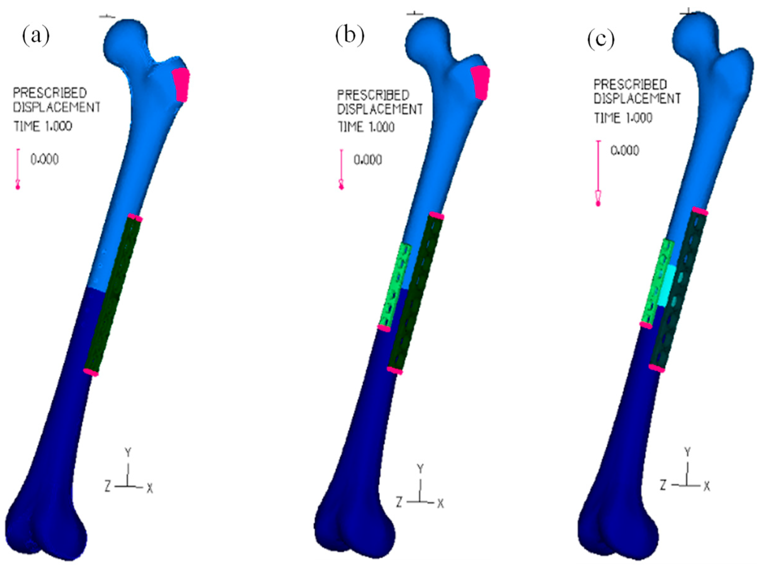 Bioengineering 11 00416 g003