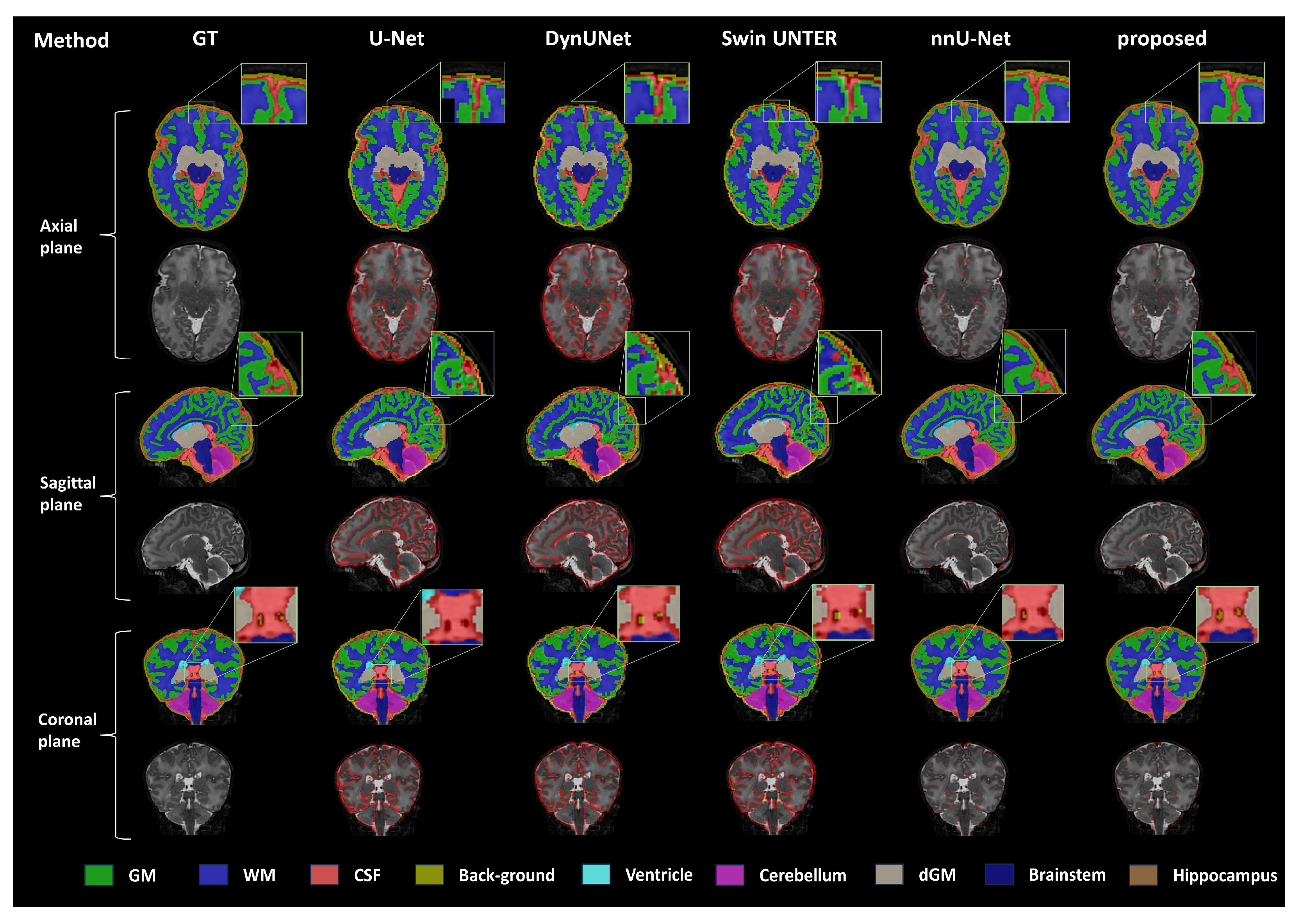 Bioengineering 11 00427 g002
