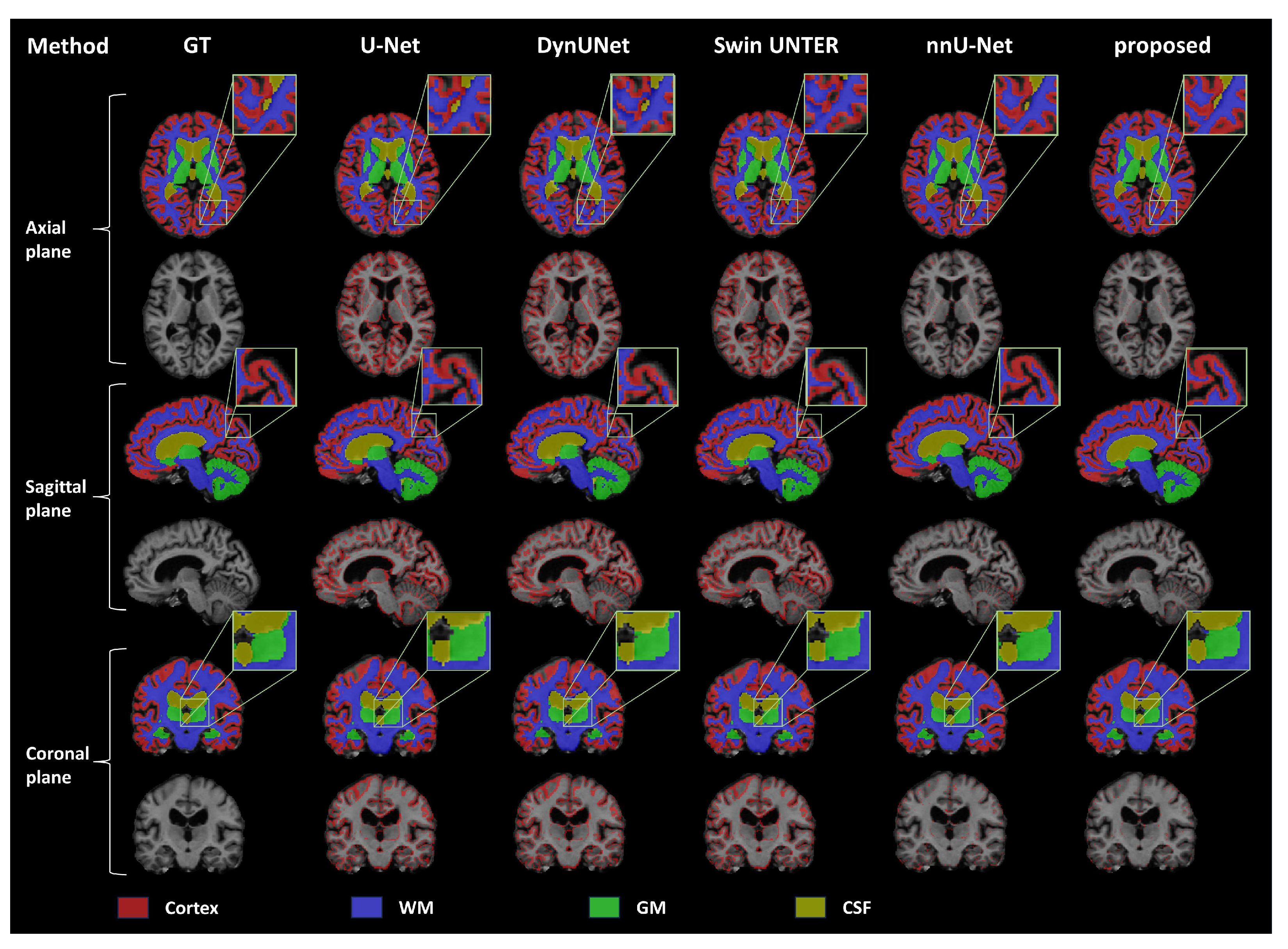 Bioengineering 11 00427 g003