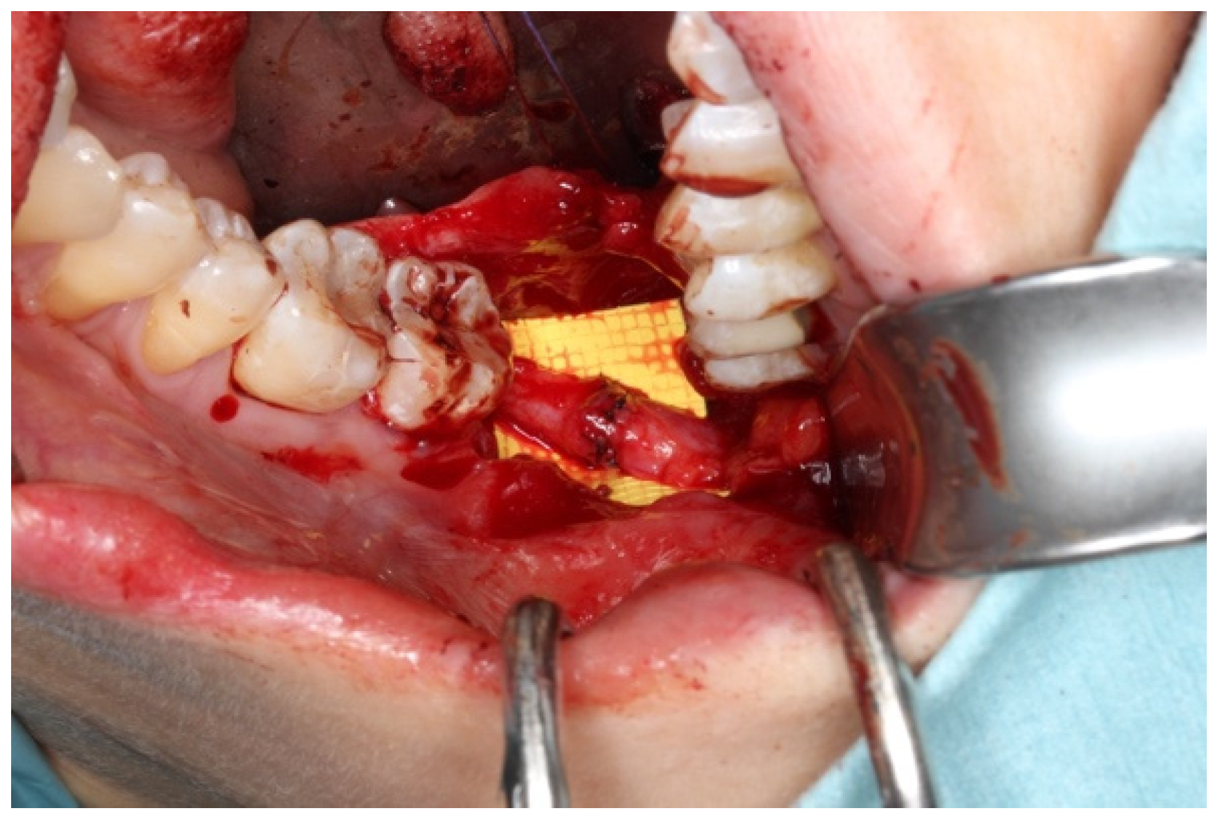 Bioengineering 11 00444 g002