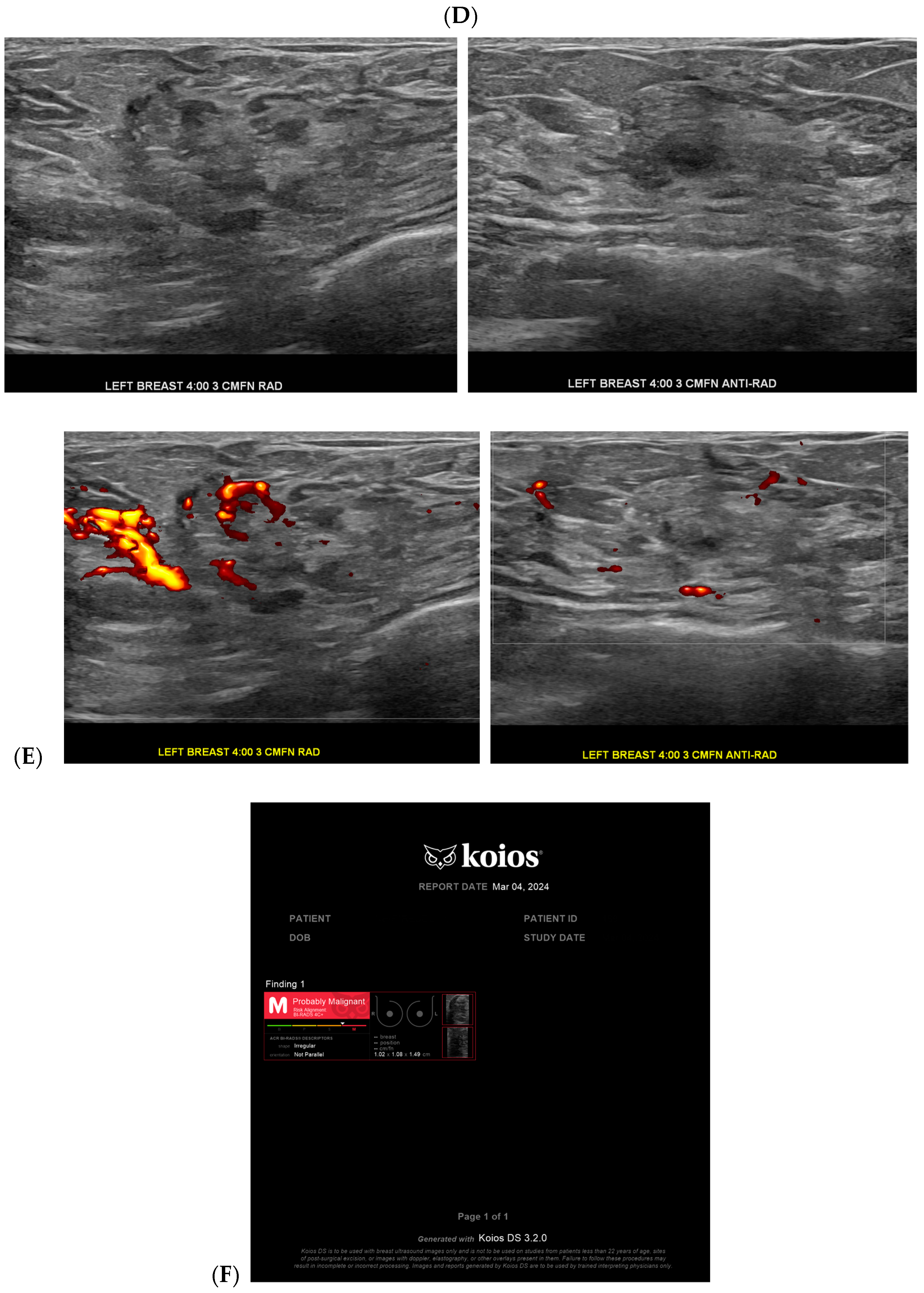 Bioengineering 11 00451 g001b