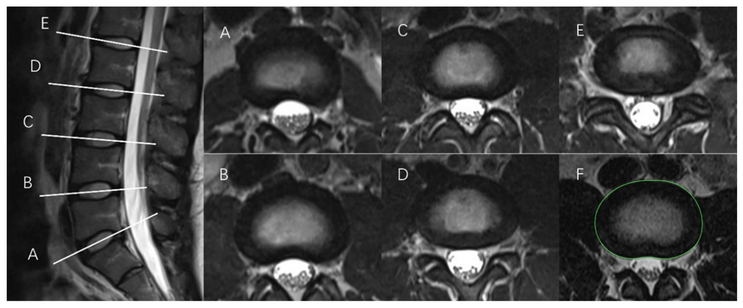 Bioengineering 11 00466 g001