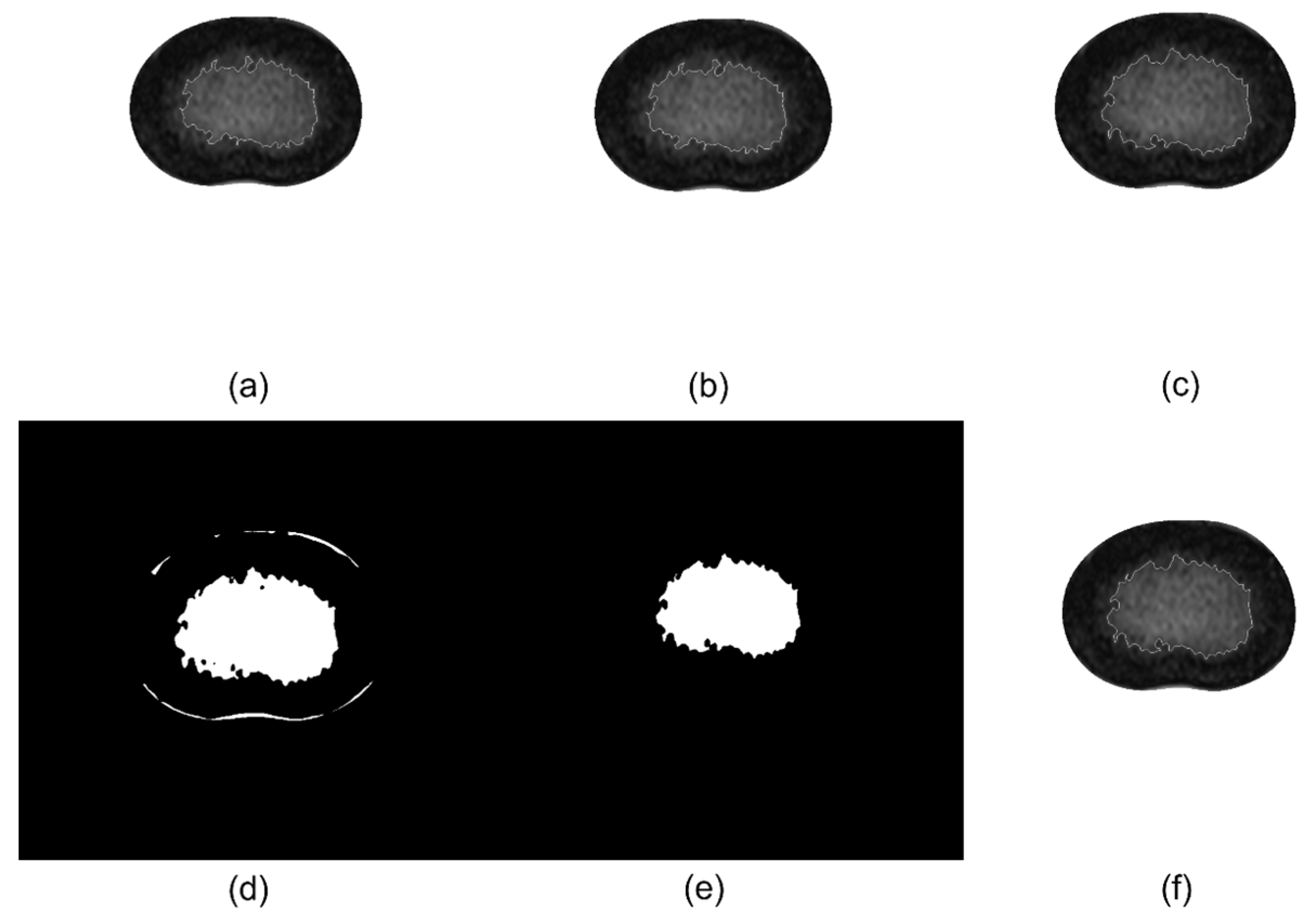 Bioengineering 11 00466 g003