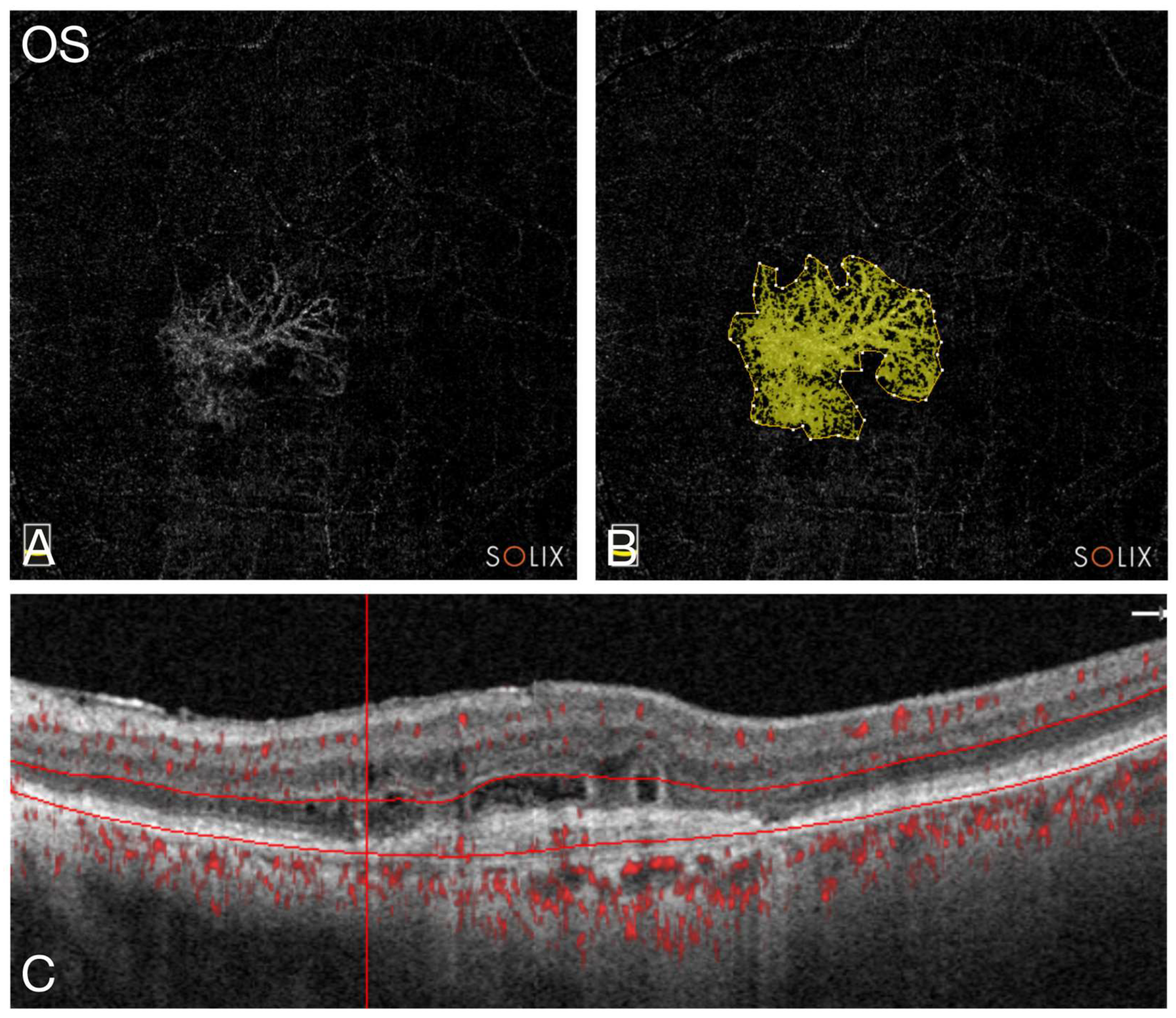 Bioengineering 11 00478 g001