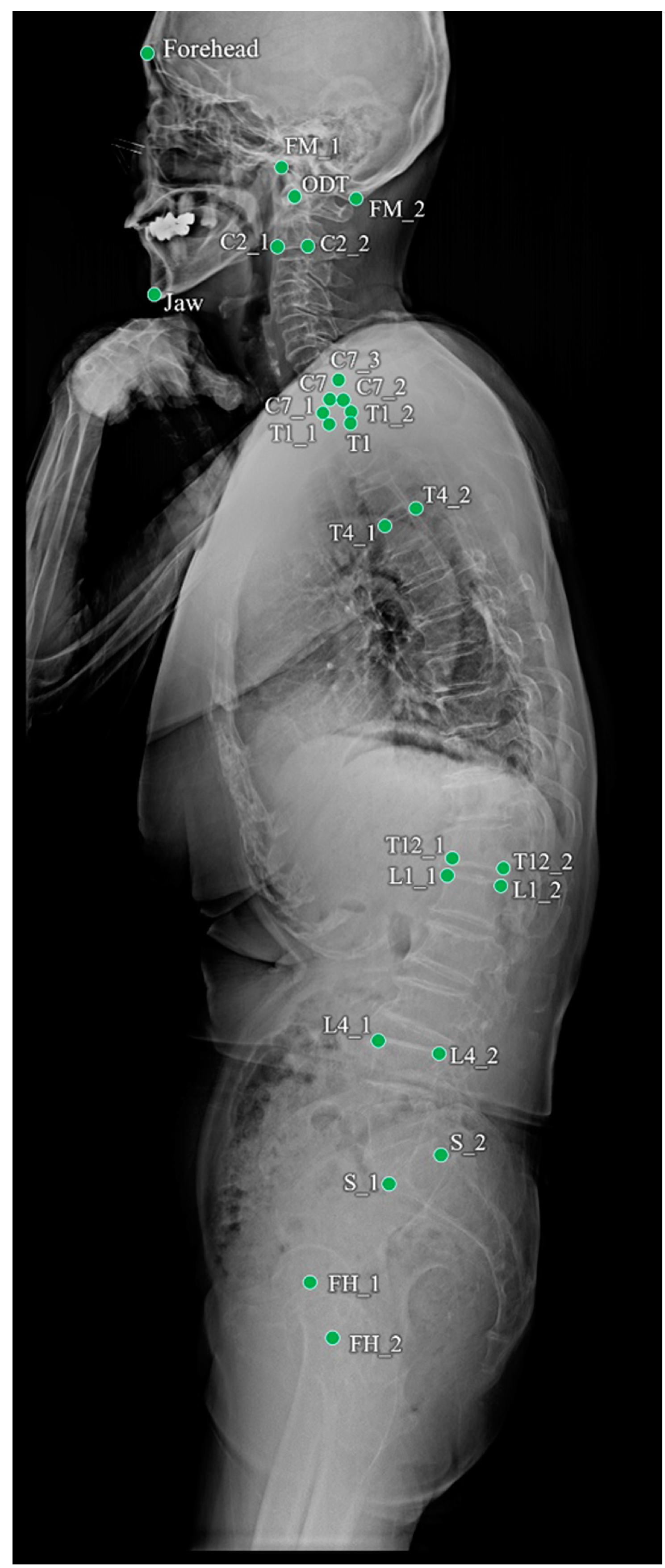 Bioengineering 11 00481 g001