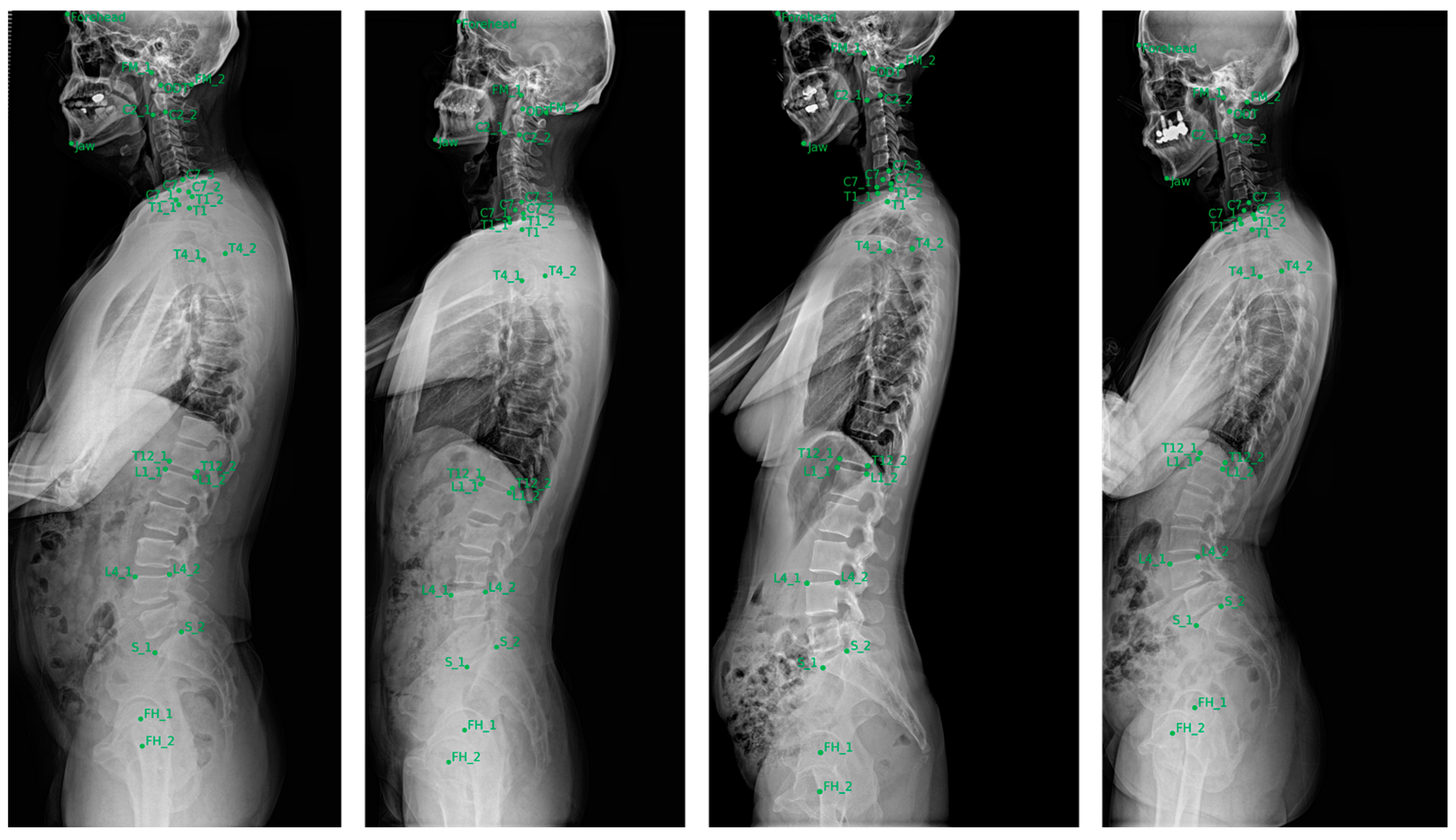 Bioengineering 11 00481 g005