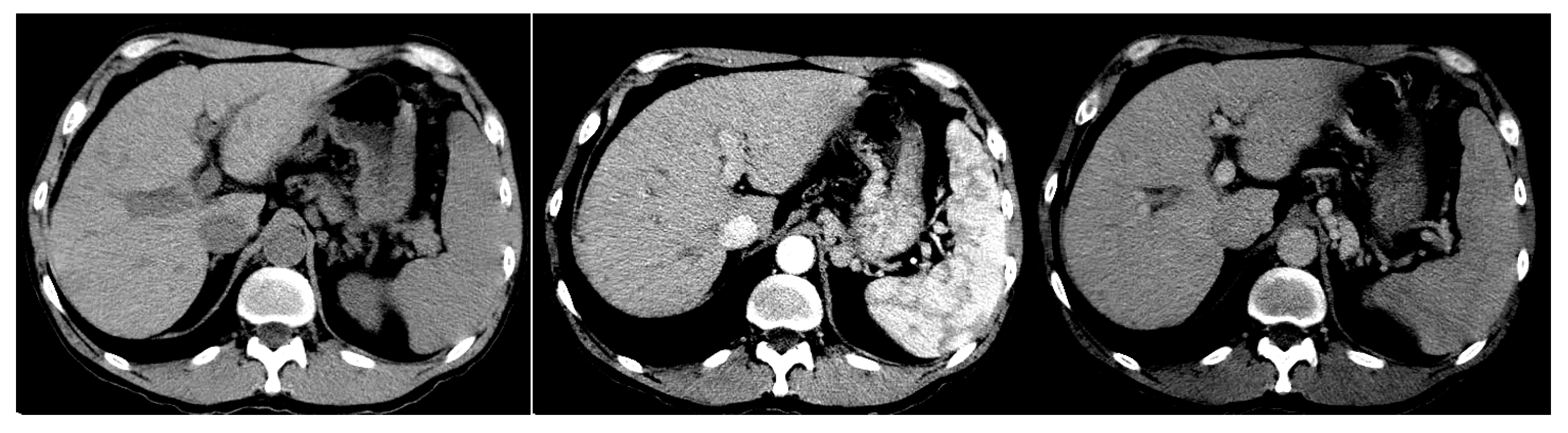 Bioengineering 11 00485 g001