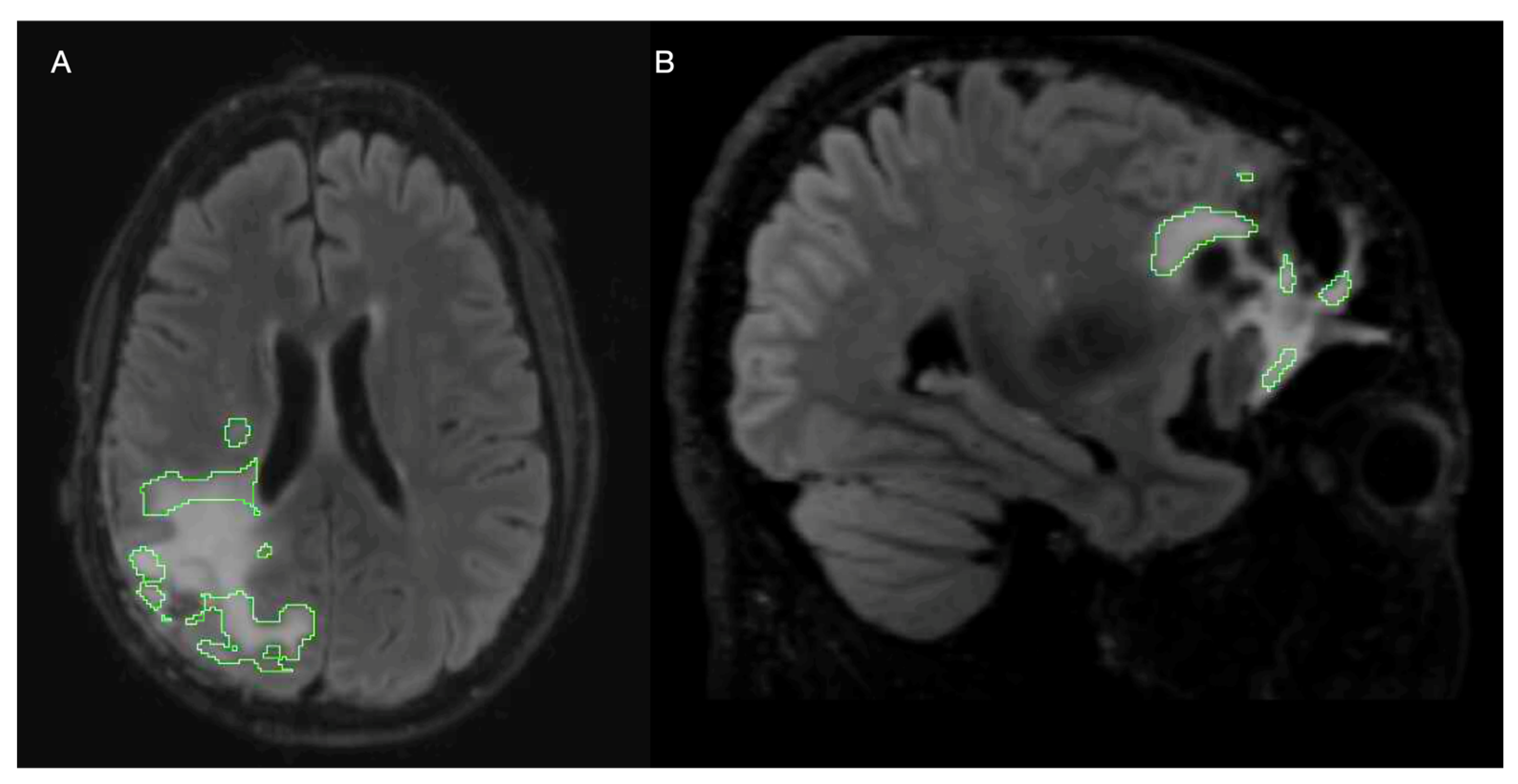 Bioengineering 11 00497 g007