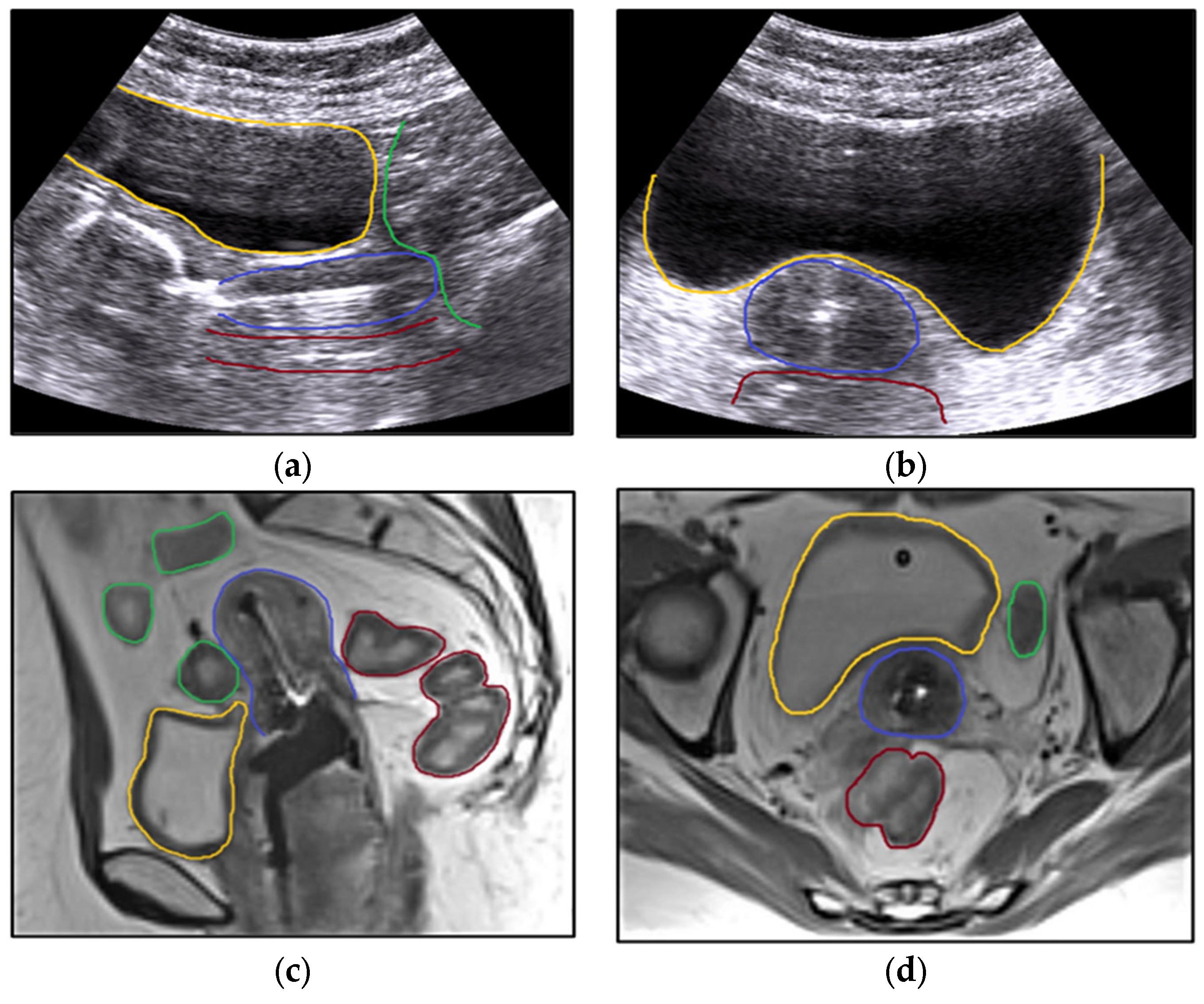 Bioengineering 11 00506 g006
