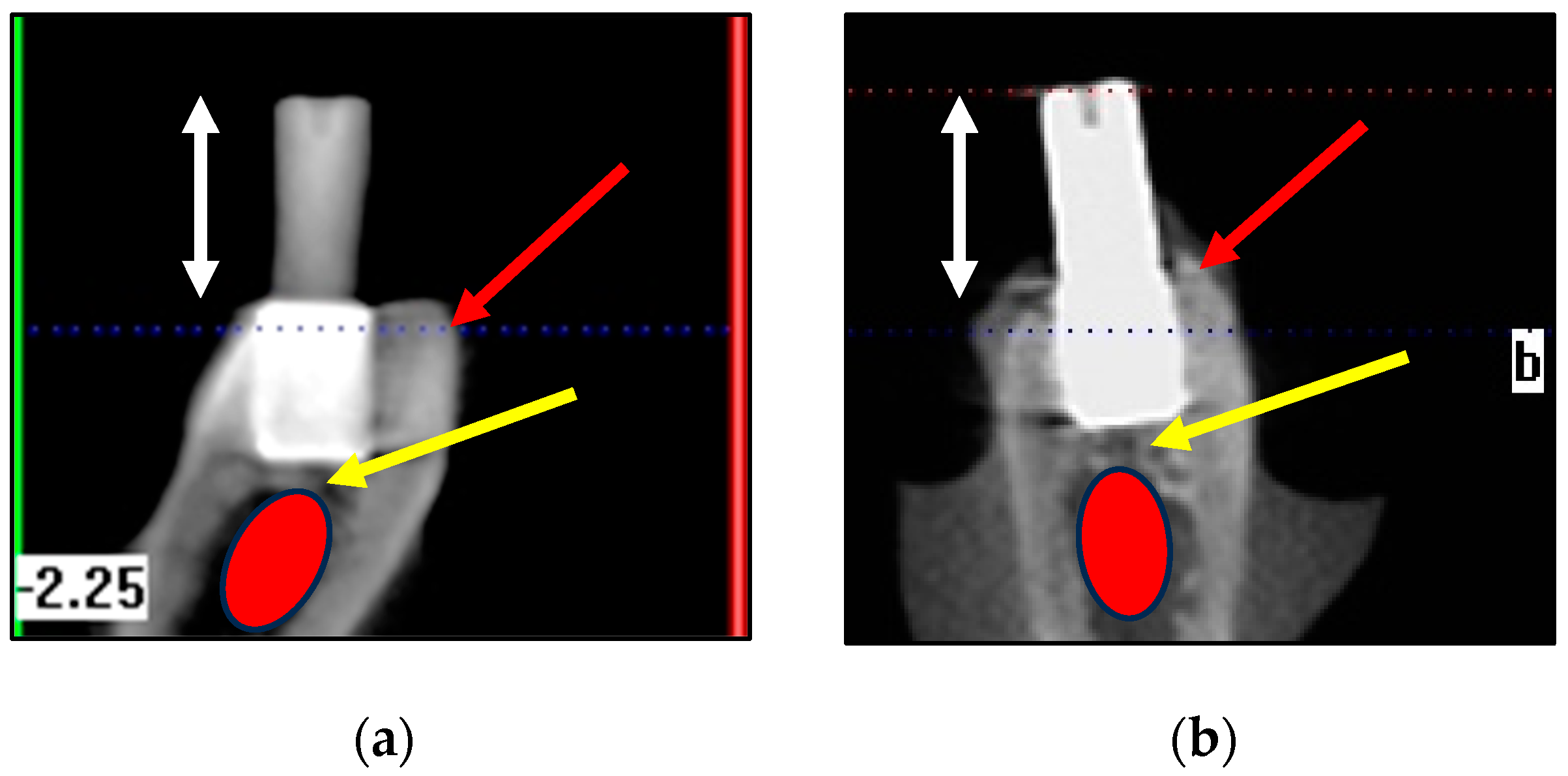 Bioengineering 11 00532 g009