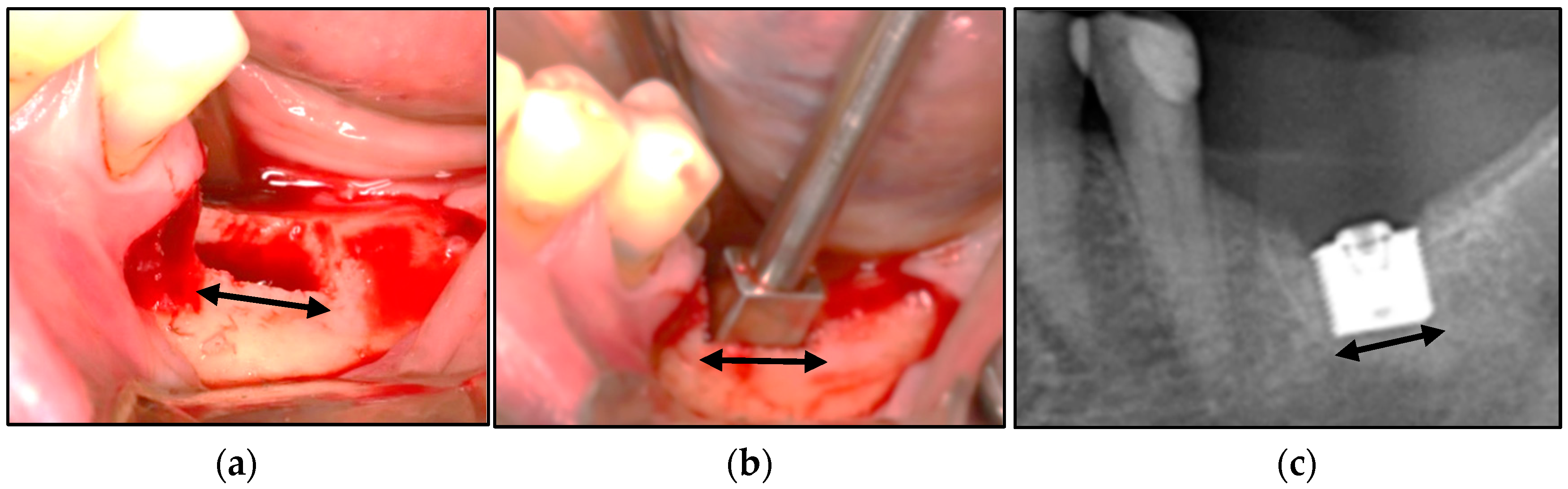 Bioengineering 11 00532 g011